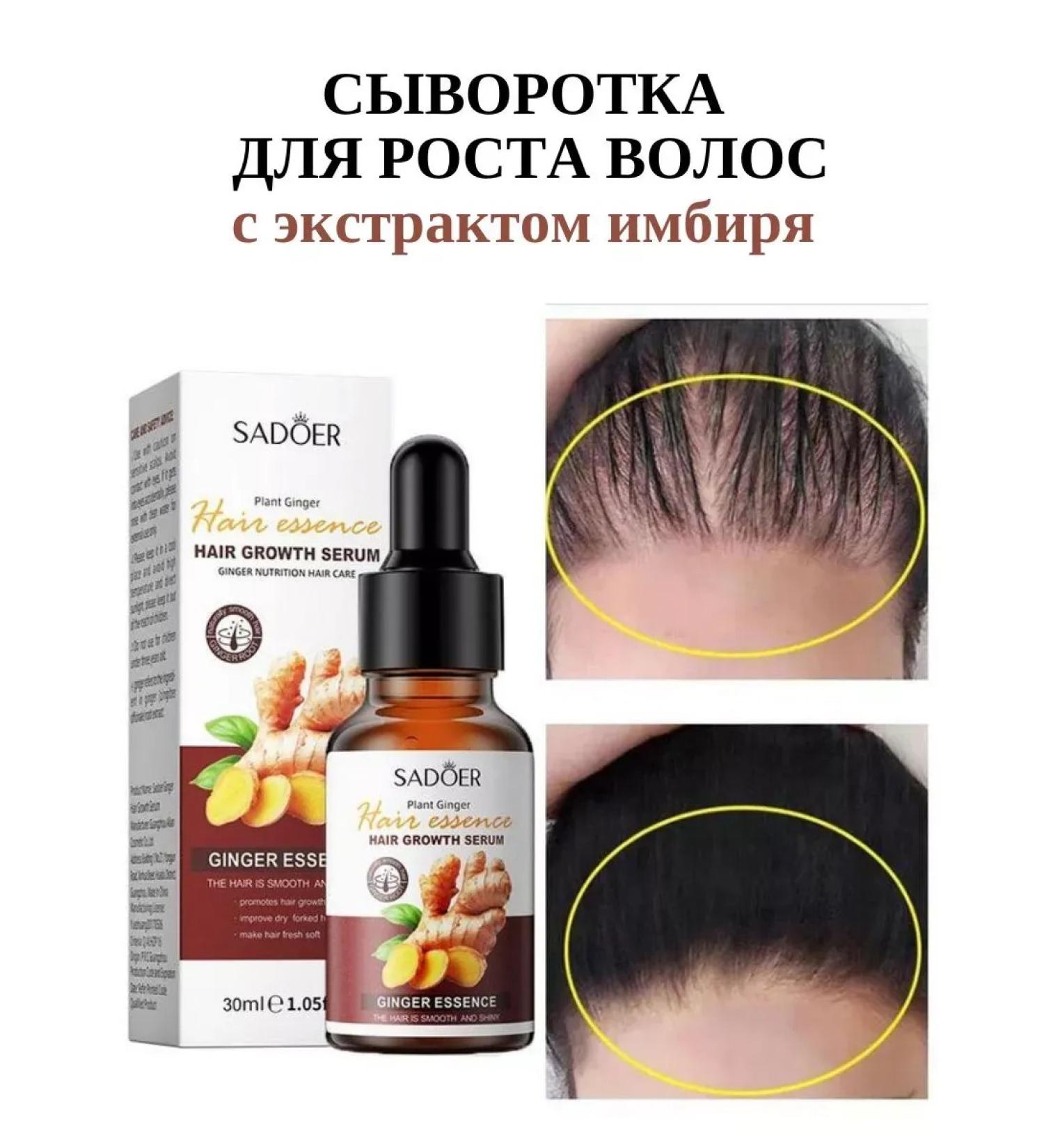 Black Friday Hair and eyebrow growth with ginger extract - Buy Online on GoSupps.com