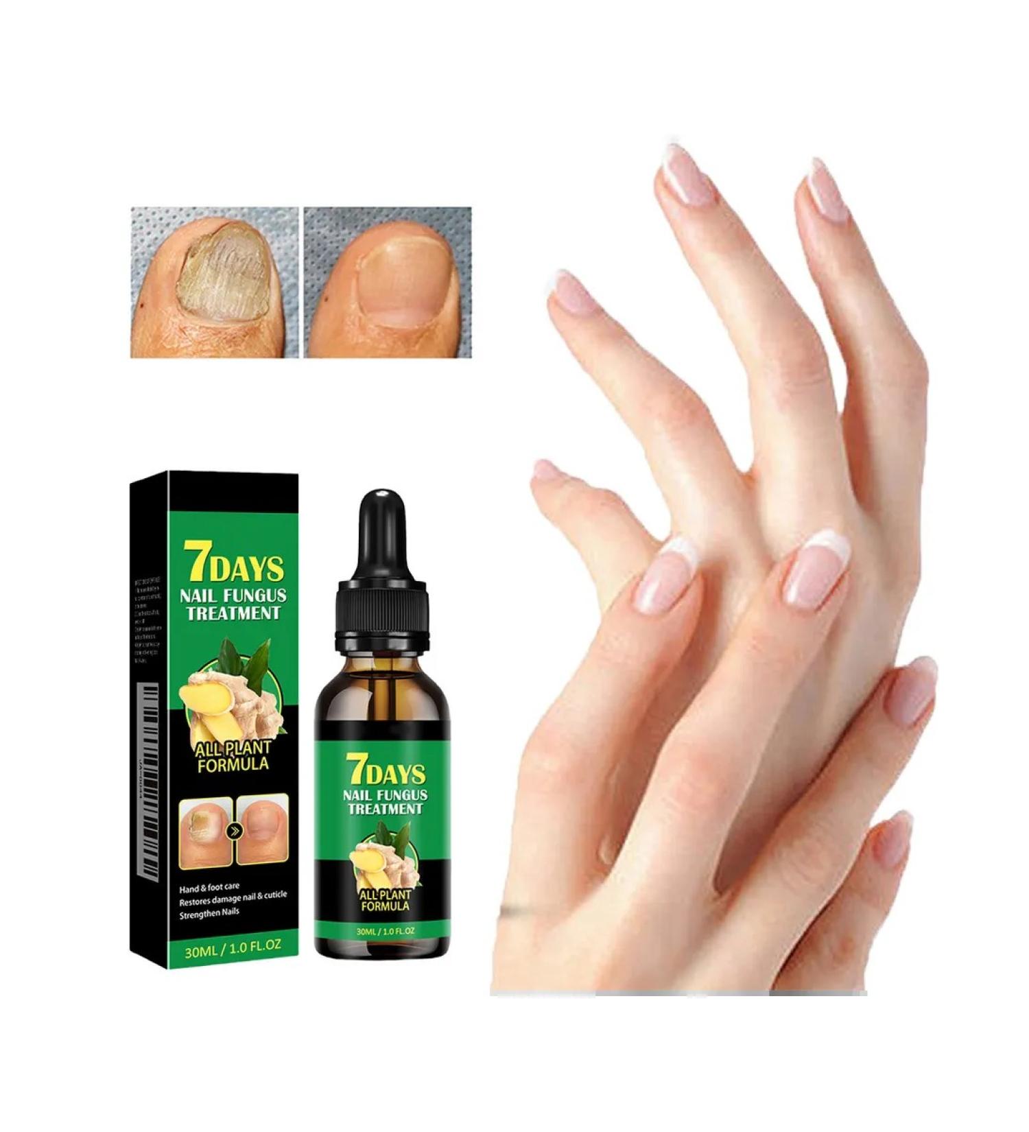 30ml oil for nail growth with ginger Clean care - Buy Online on GoSupps.com