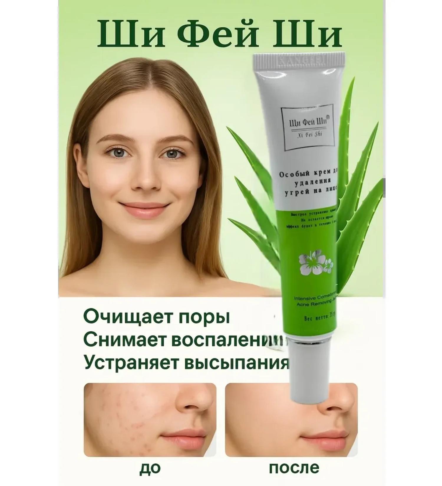 Warehouse77 Acne cream and acne for the face and body - Buy Online on GoSupps.com
