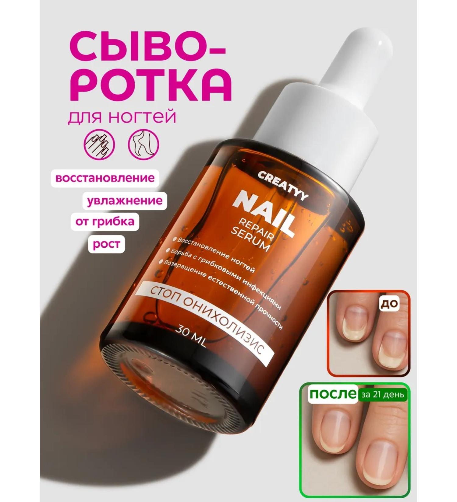Creatyy Serum for the growth of nails against the fungus of stop onycholysis - Buy Online on GoSupps.com