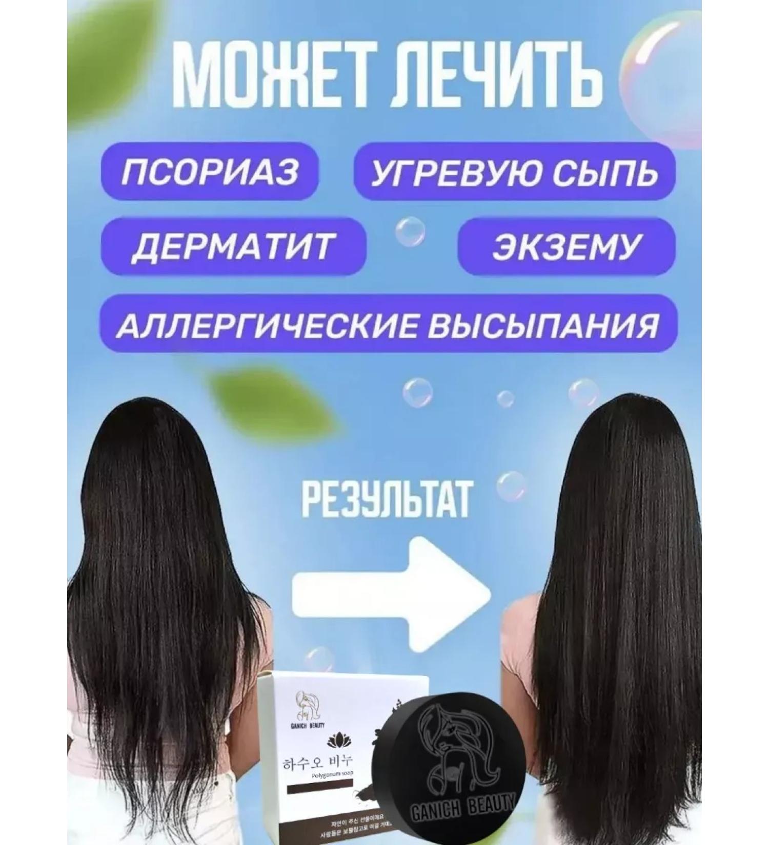 MousseEdge Korean black soap from loss and hair growth - Buy Online on GoSupps.com