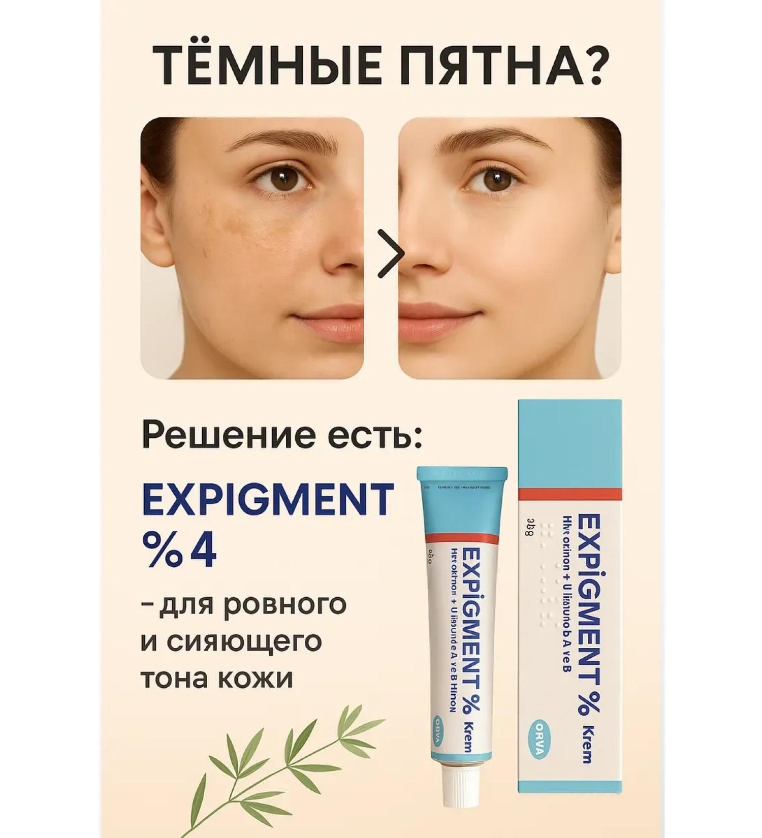 Dalil Expigment 4% cream from age spots and post -acne - Buy Online on GoSupps.com