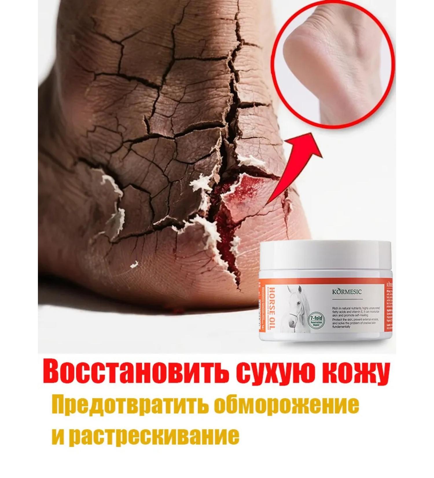 Restore dry skin to restore the arms and legs - Buy Online on GoSupps.com