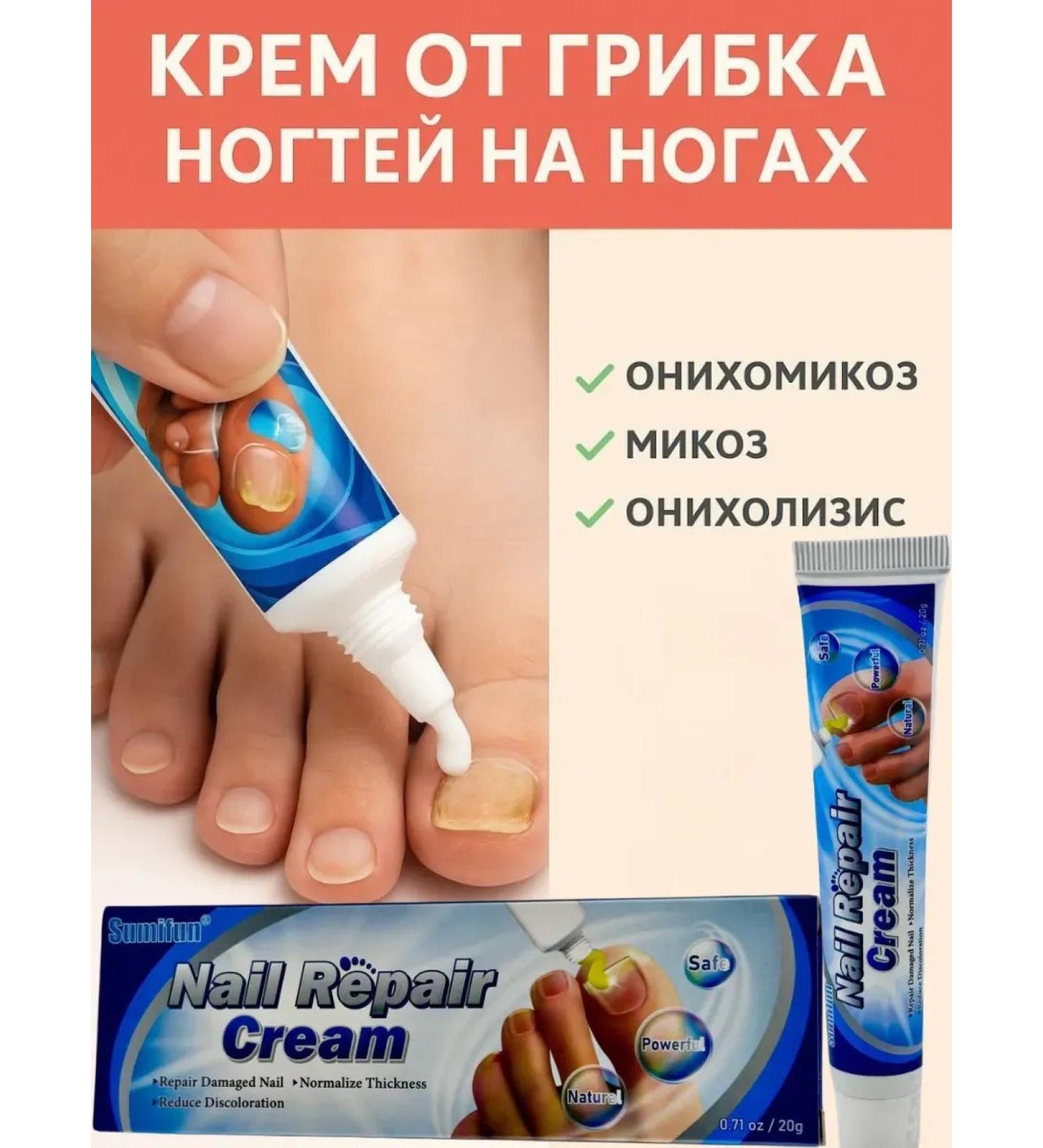 Nadi Fleet fungus cream - Buy Online on GoSupps.com