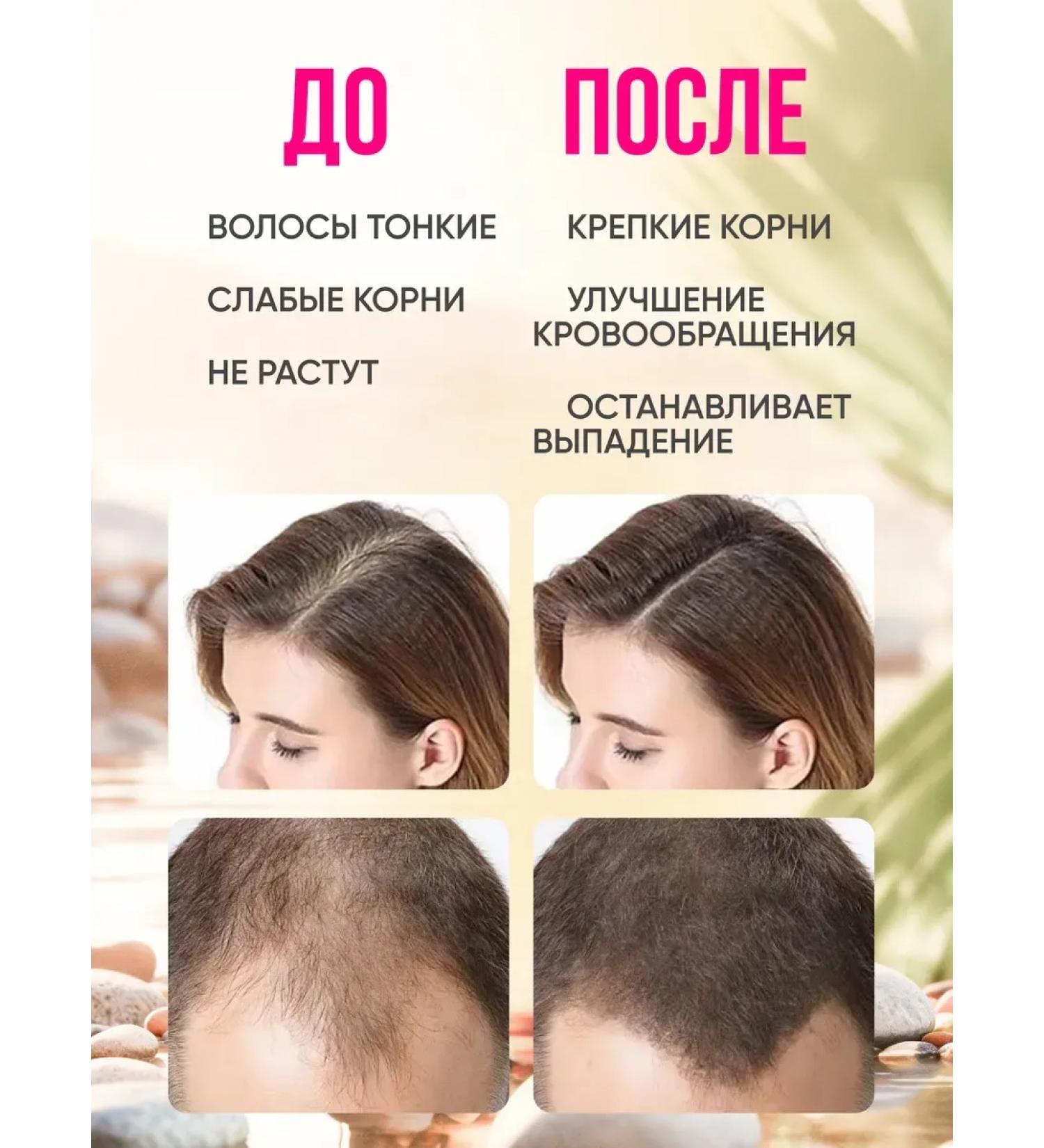 SeruZone hair serum - Buy Online on GoSupps.com