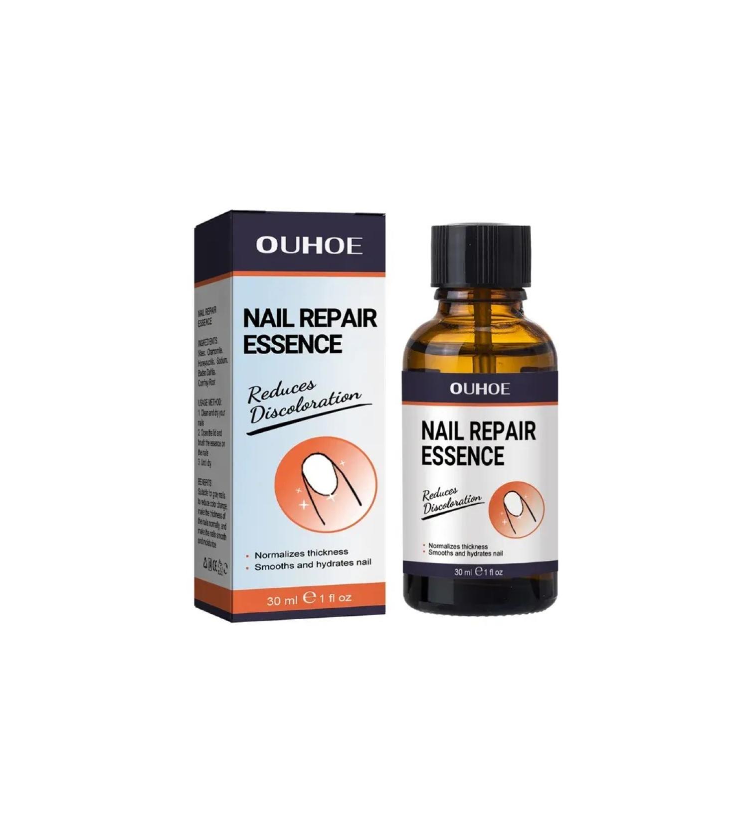 Ouhoe Restore damaged nails the essence to remove fungi - Buy Online on GoSupps.com