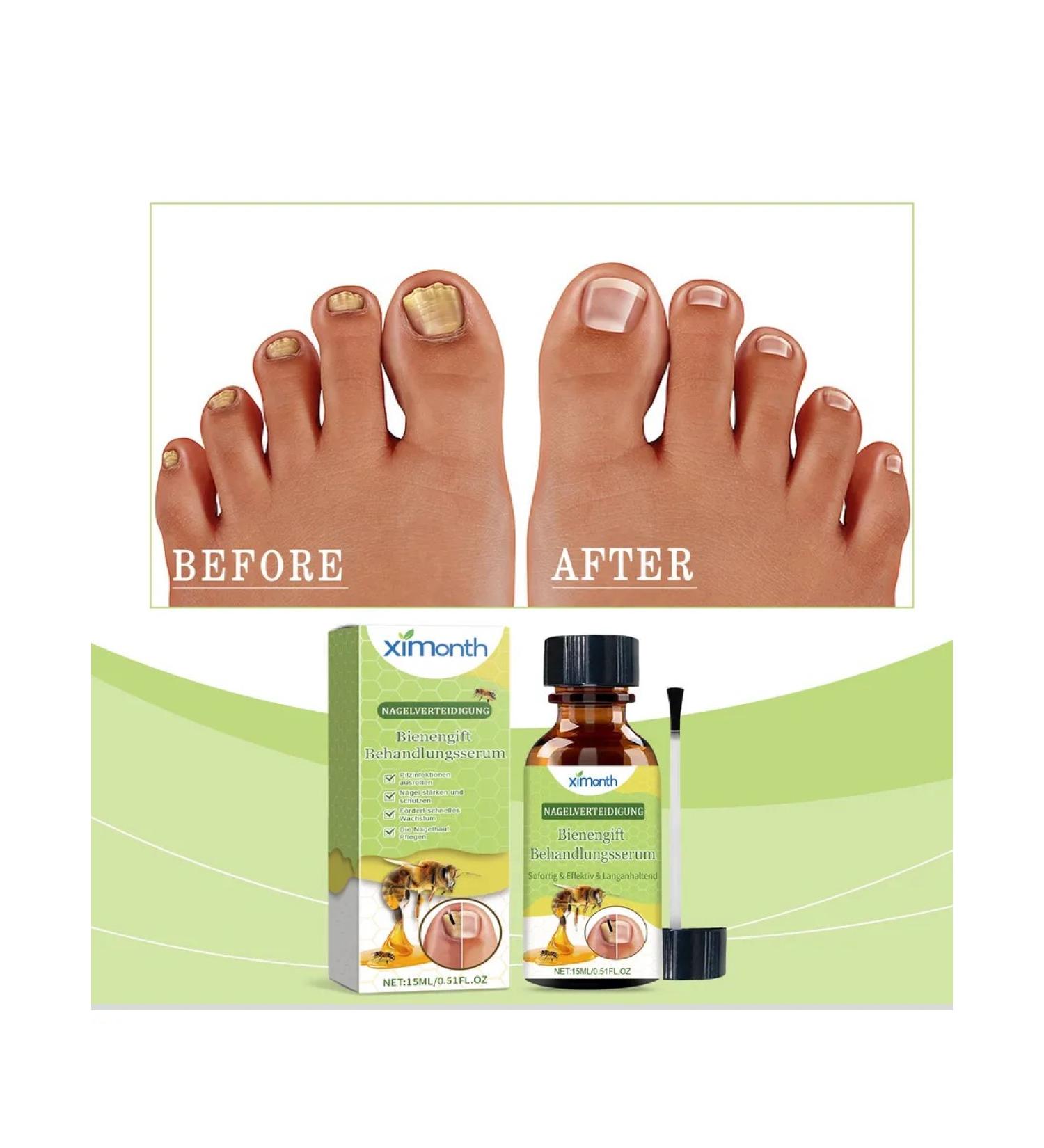 Nail care restoring cream 15 ml - Buy Online on GoSupps.com
