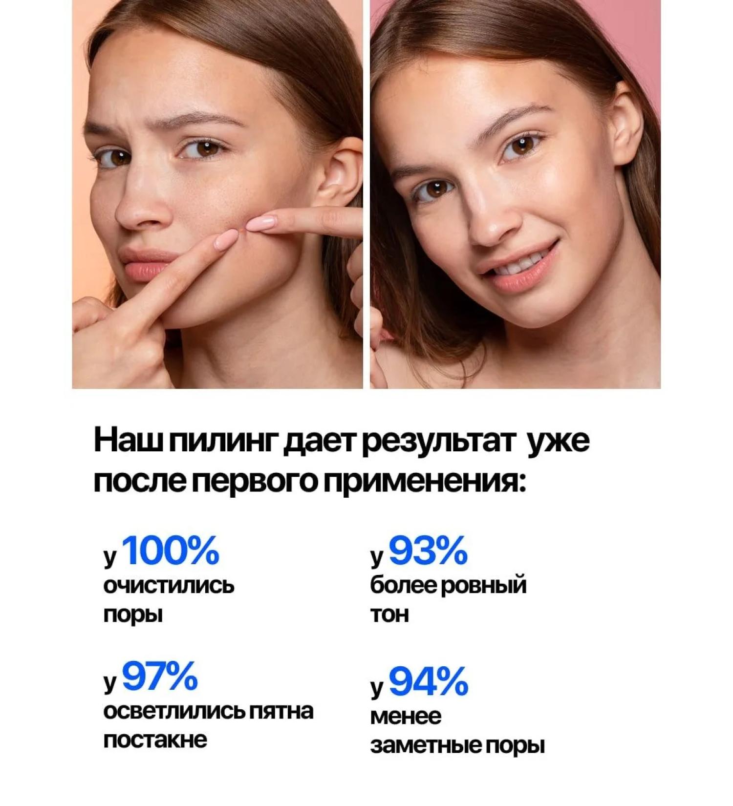 PeelingOnline Facial peeling - Buy Online on GoSupps.com