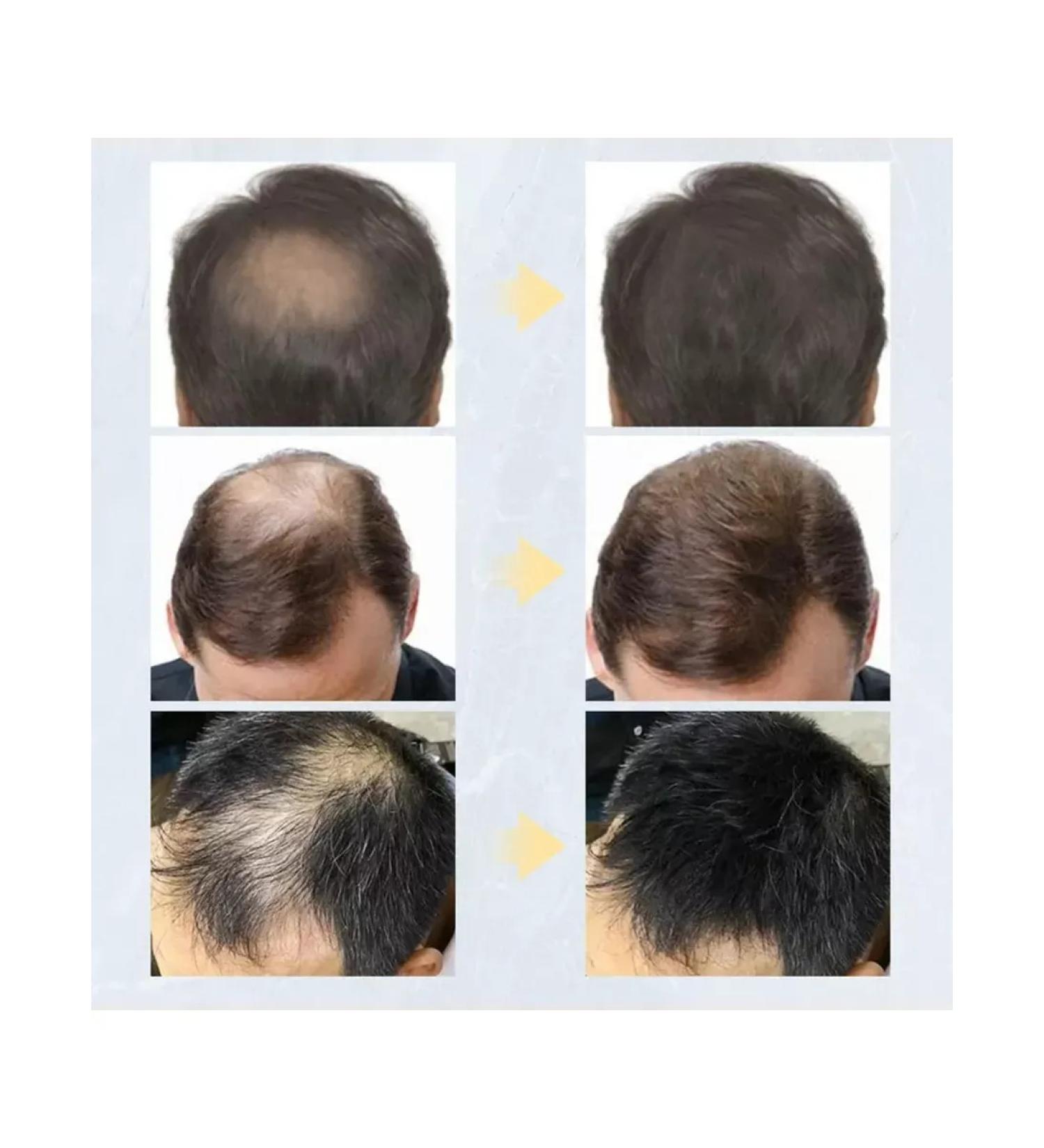 ThickenersBox Thickener for hair and beard powder - Buy Online on GoSupps.com