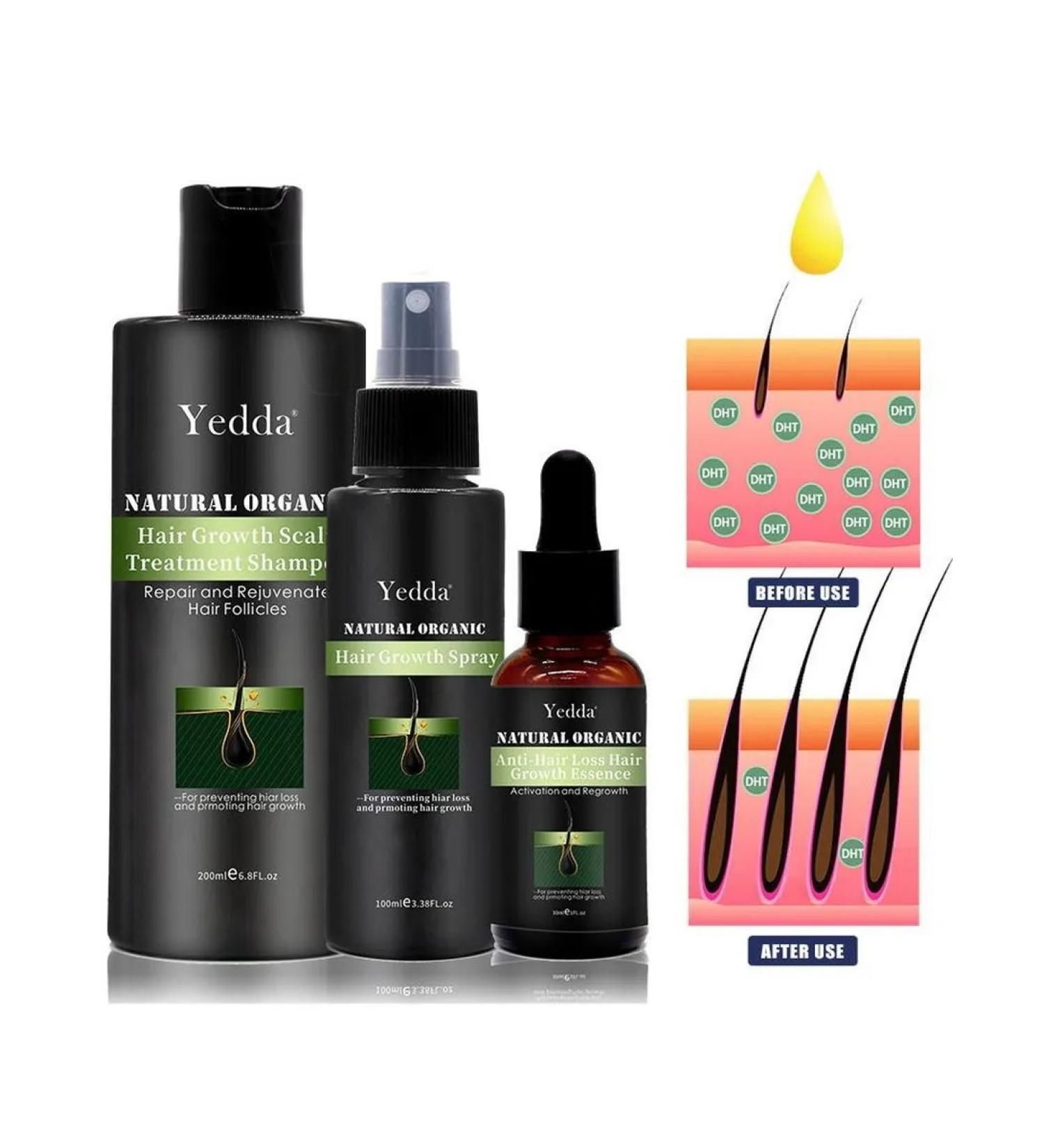 ShampoosEnter Anti-hair loss shampoo - Buy Online on GoSupps.com