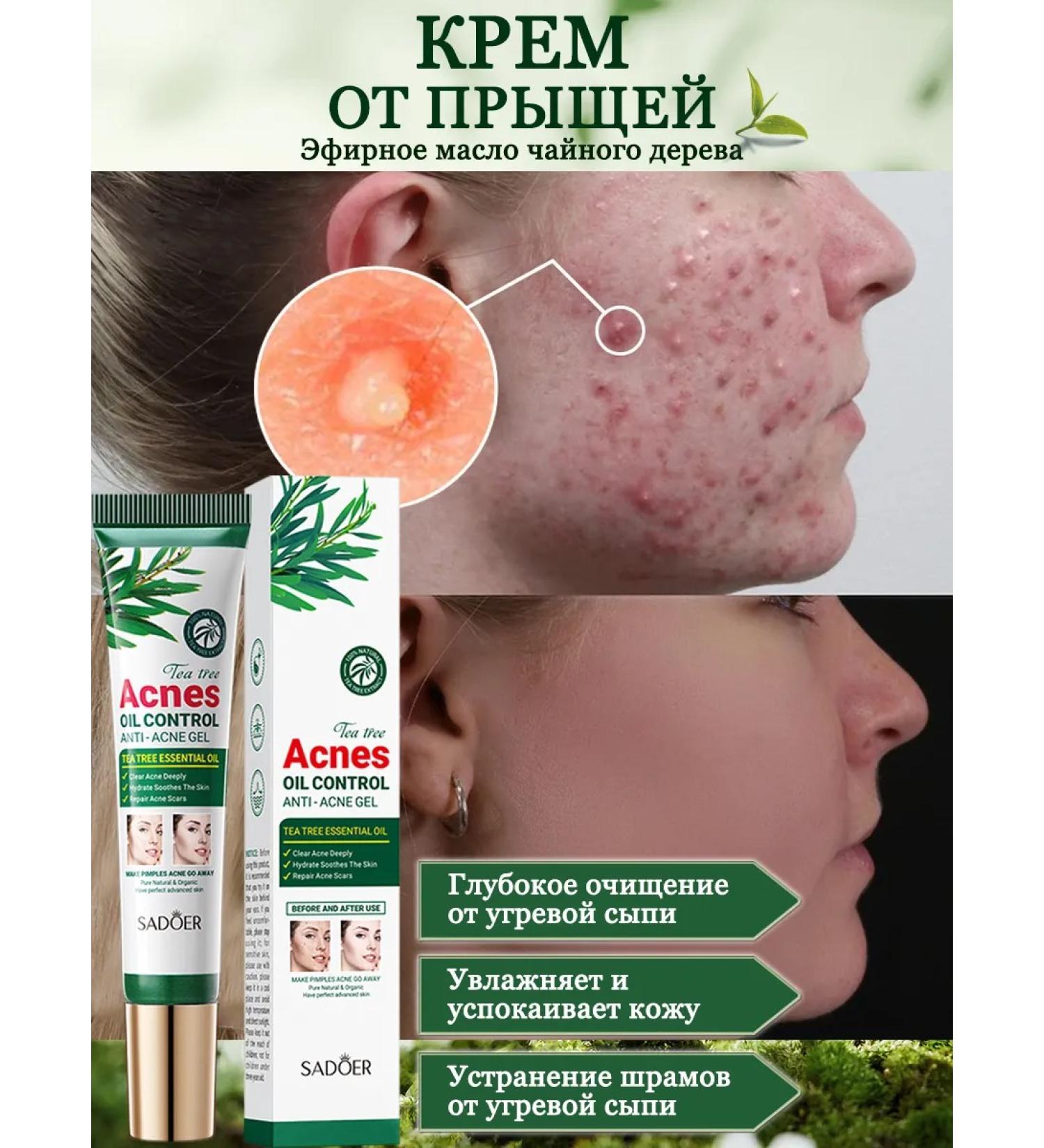 SADOER OFFICIAL Acne cream for face - Buy Online on GoSupps.com