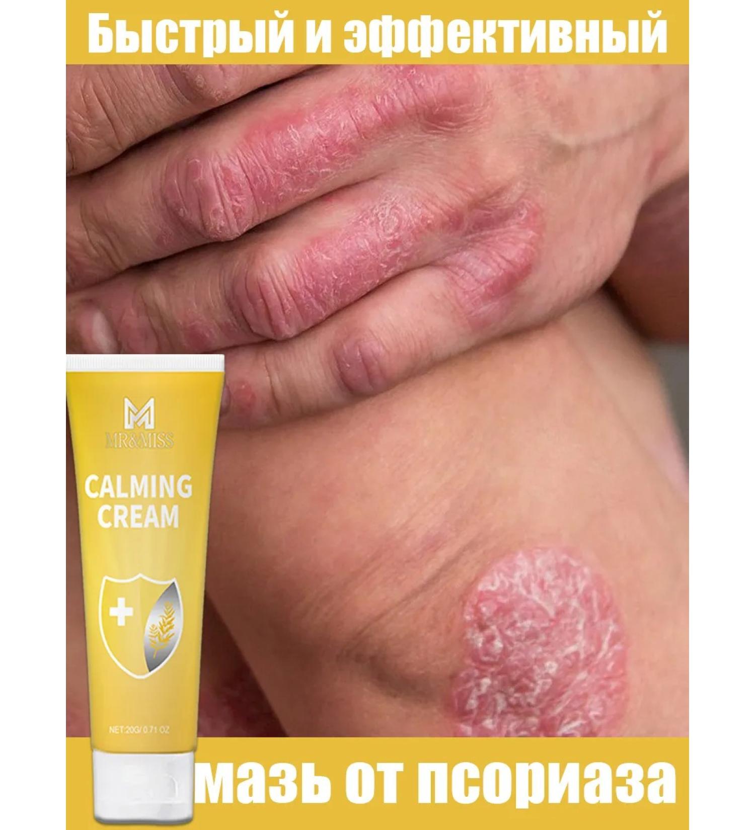 Ointment from psoriasis from eczema from dermatystabystro and effectively - Buy Online on GoSupps.com