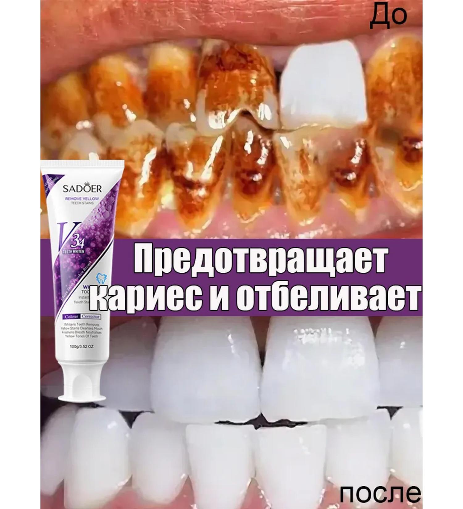 Toothpaste whitening from bleeding and caries - Buy Online on GoSupps.com