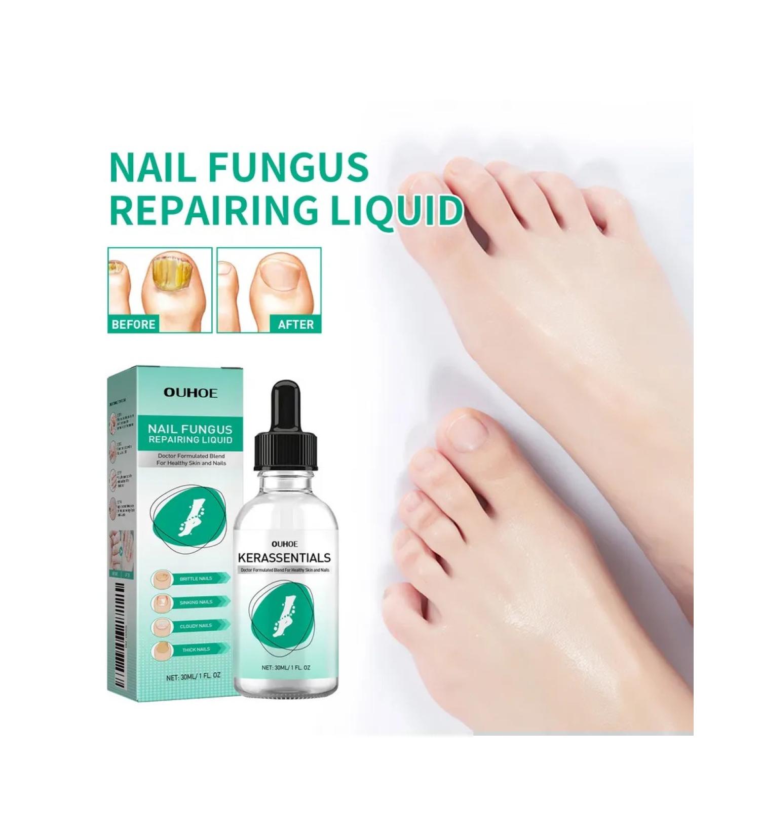 Ouhoe nail care solution - Buy Online on GoSupps.com
