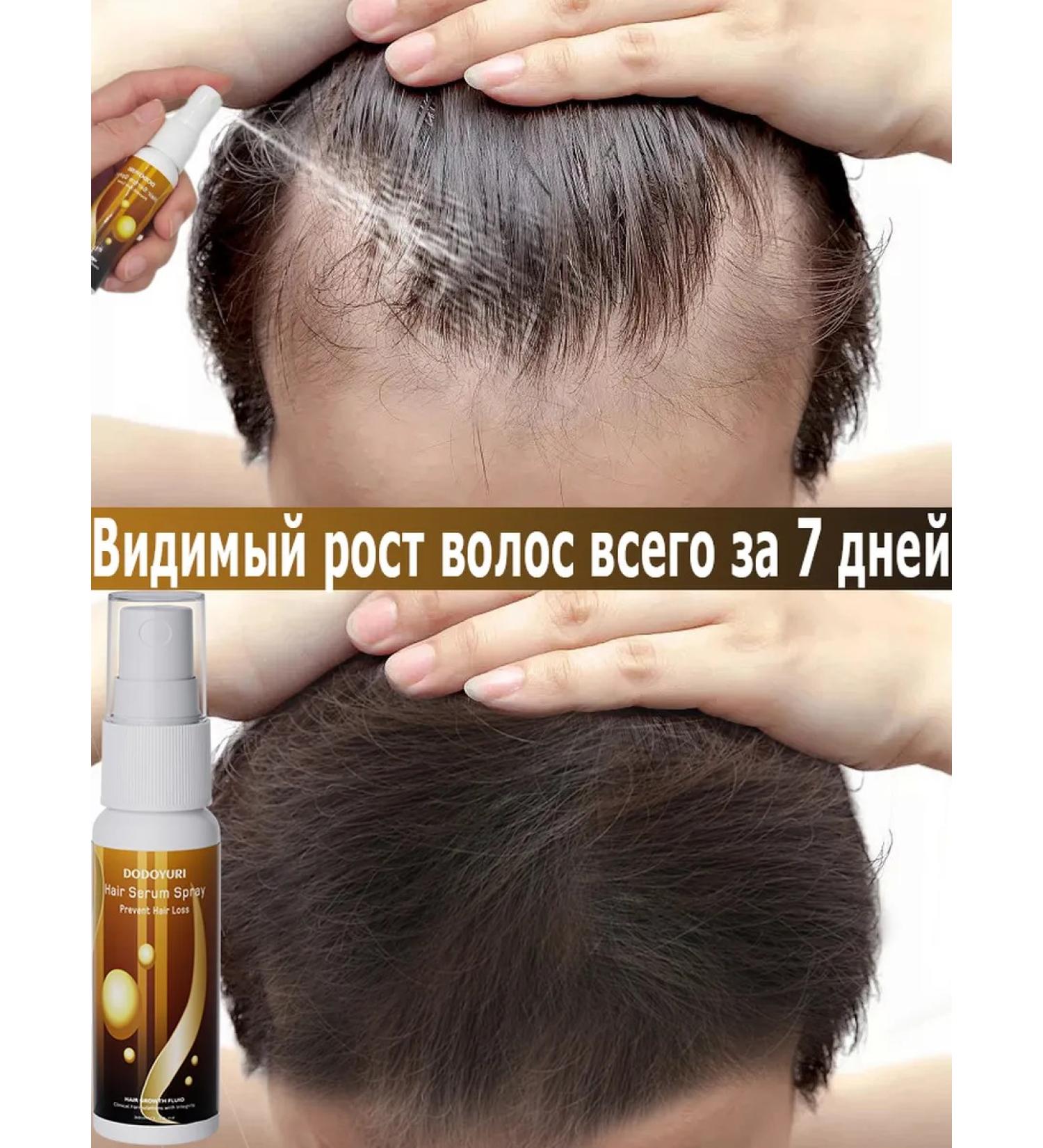 Professional Hair growth Dodoyuri - Buy Online on GoSupps.com