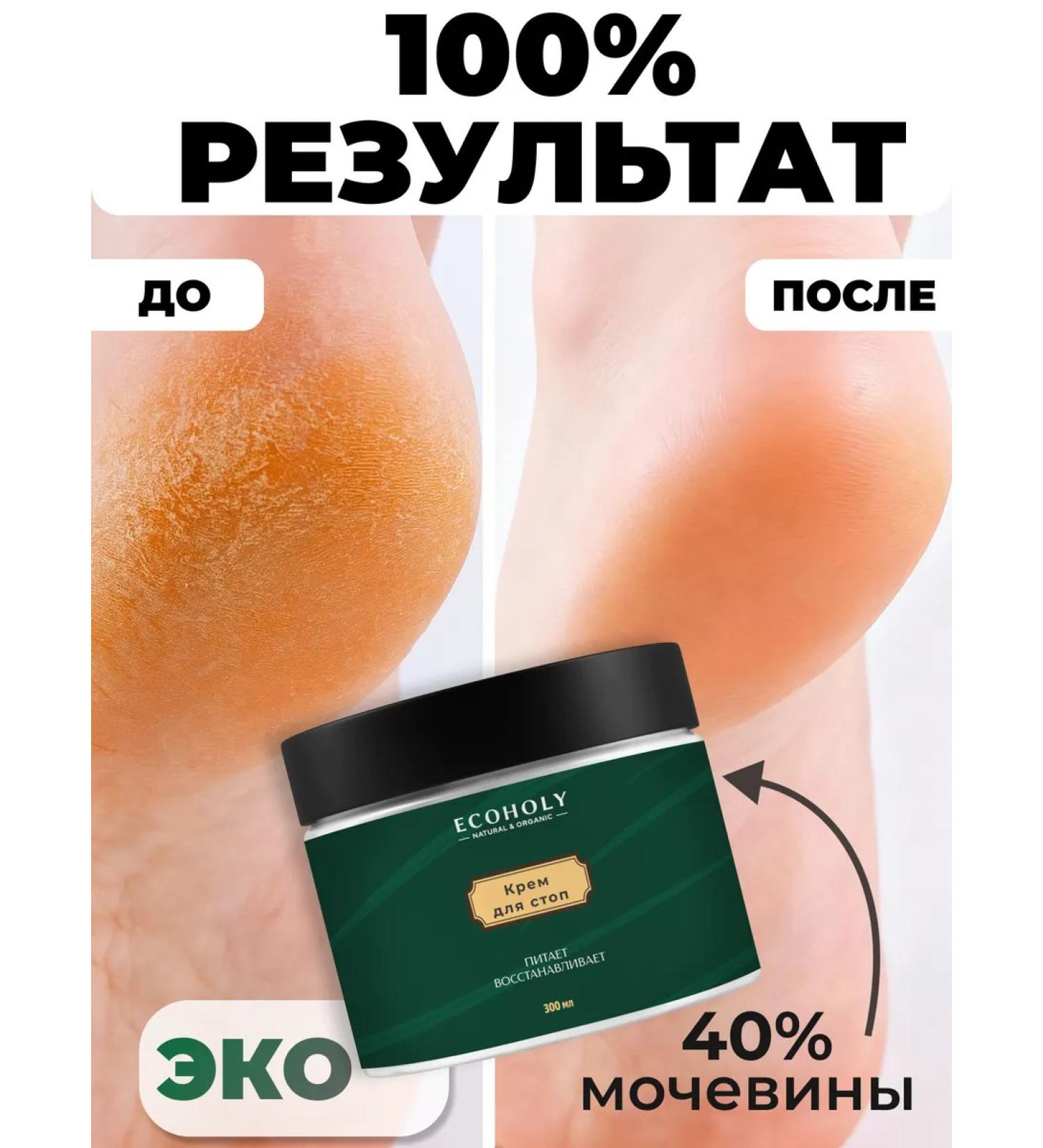 ECOHOLY LC Feet cream with urea cream gel for feet - Buy Online on GoSupps.com