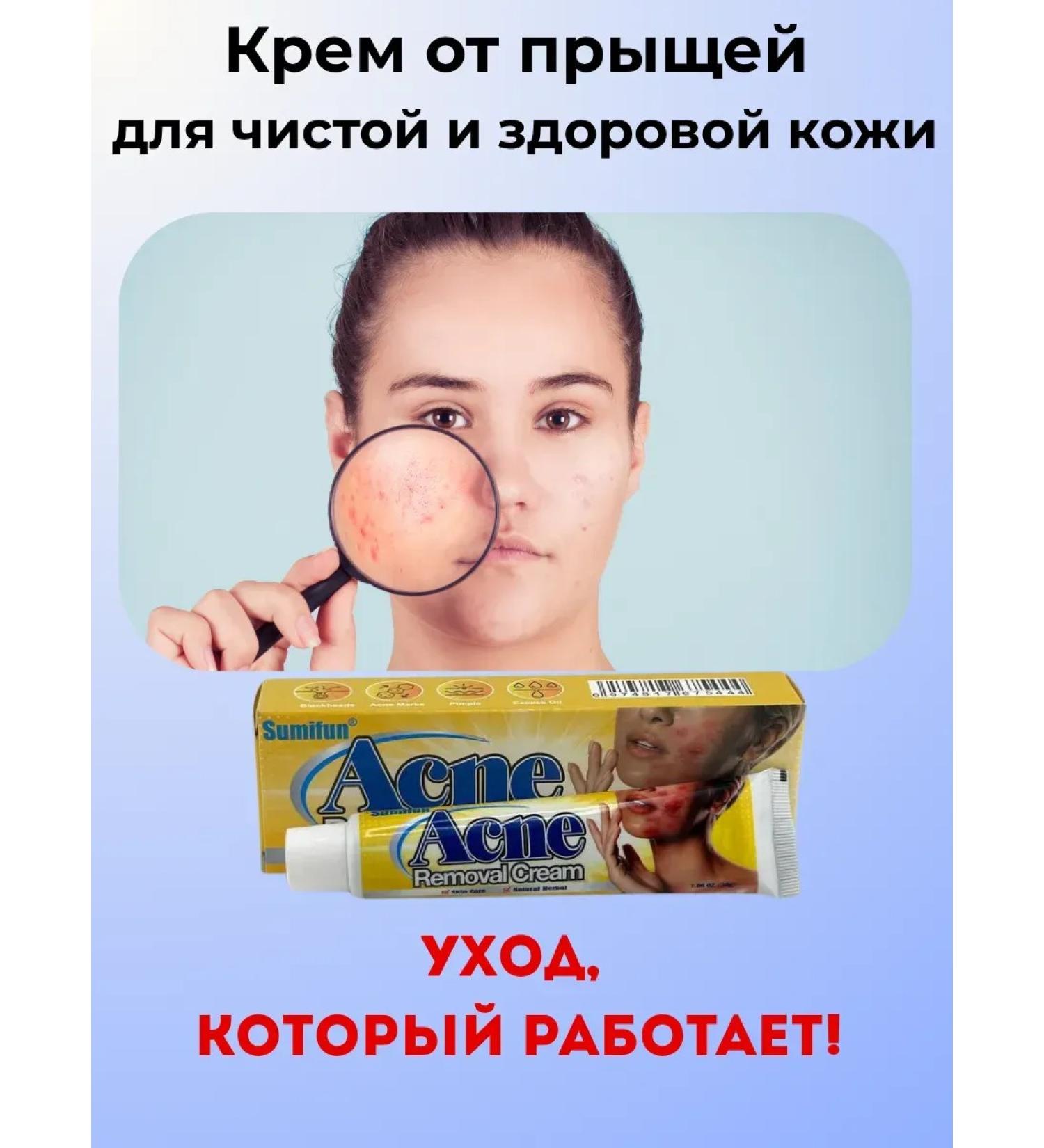 Ailuu Acne cream on the face and body - Buy Online on GoSupps.com