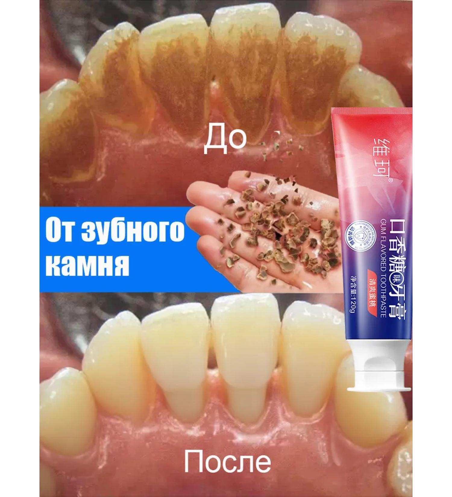 Toothpaste whitening from plaque and stone Fresh breath - Buy Online on GoSupps.com