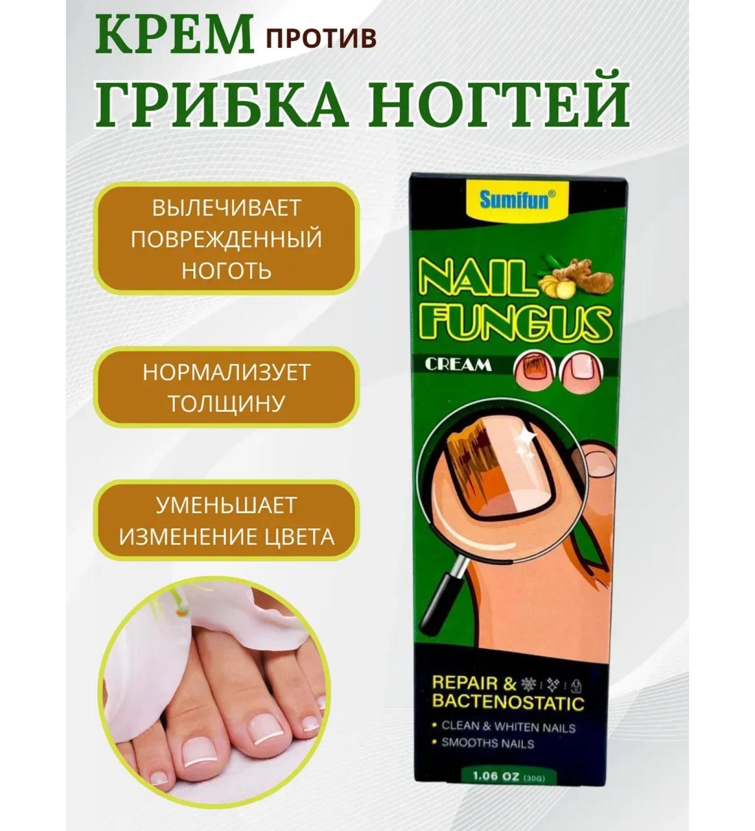 zoomba Anti-nail fungus cream - Buy Online on GoSupps.com