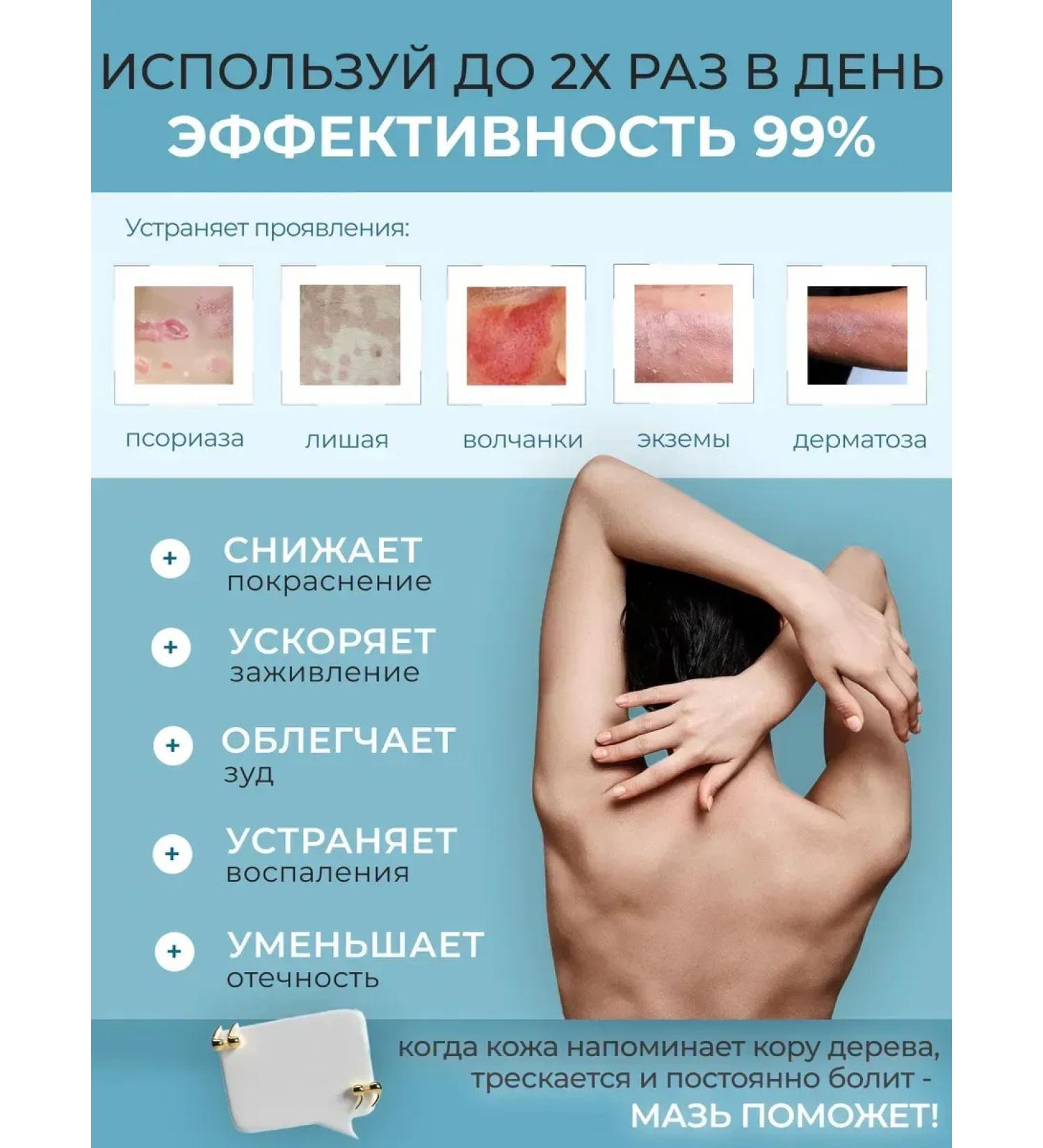 Ointment from psoriasis - Buy Online on GoSupps.com