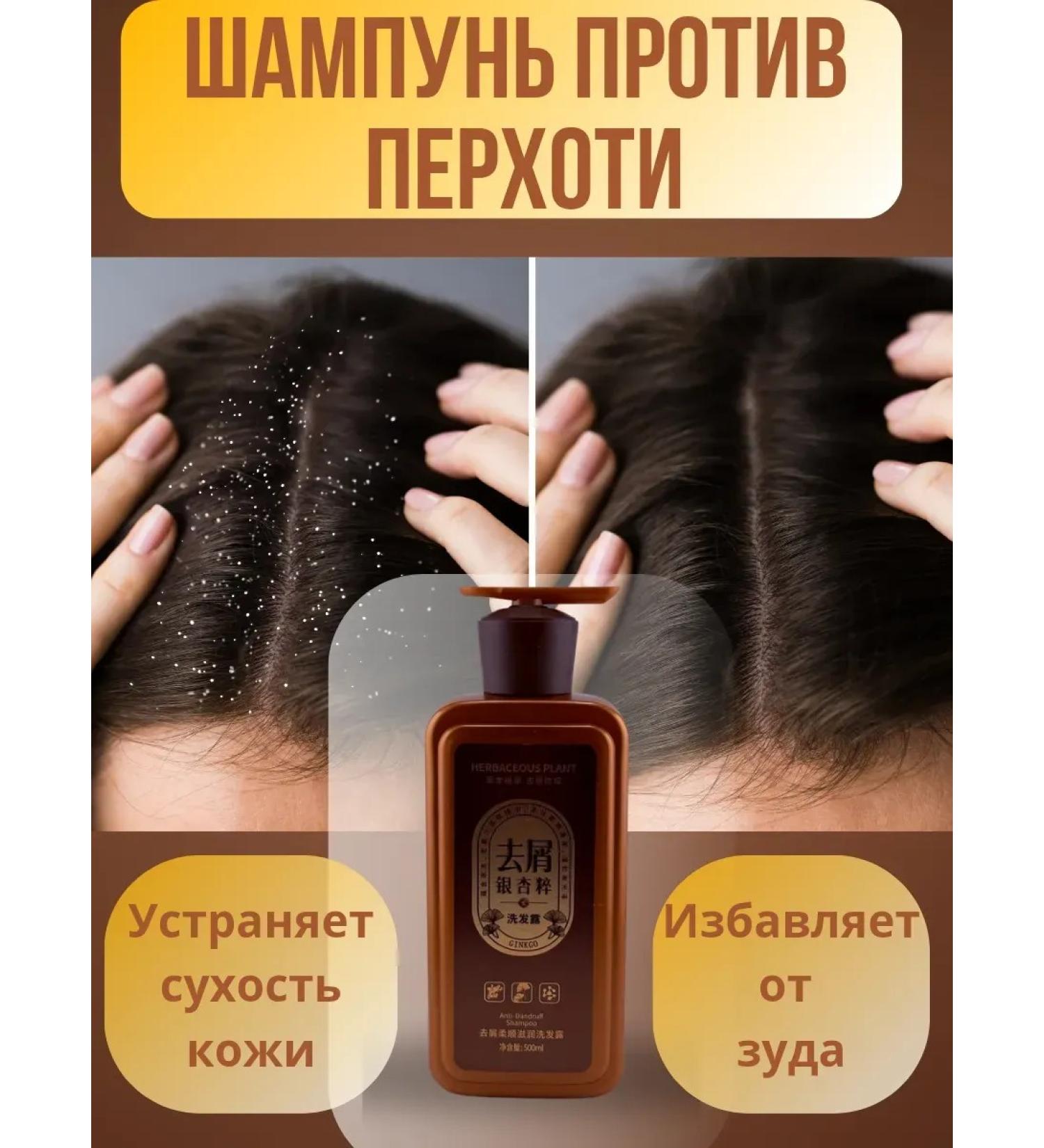 VipZak Moisturizing shampoo against dry scalp and dandruff - Buy Online on GoSupps.com
