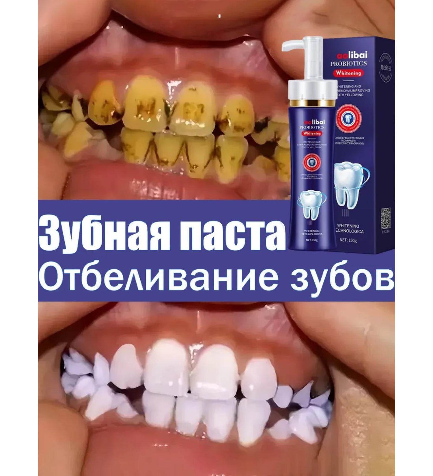 bleaching toothpaste 150g - Buy Online on GoSupps.com