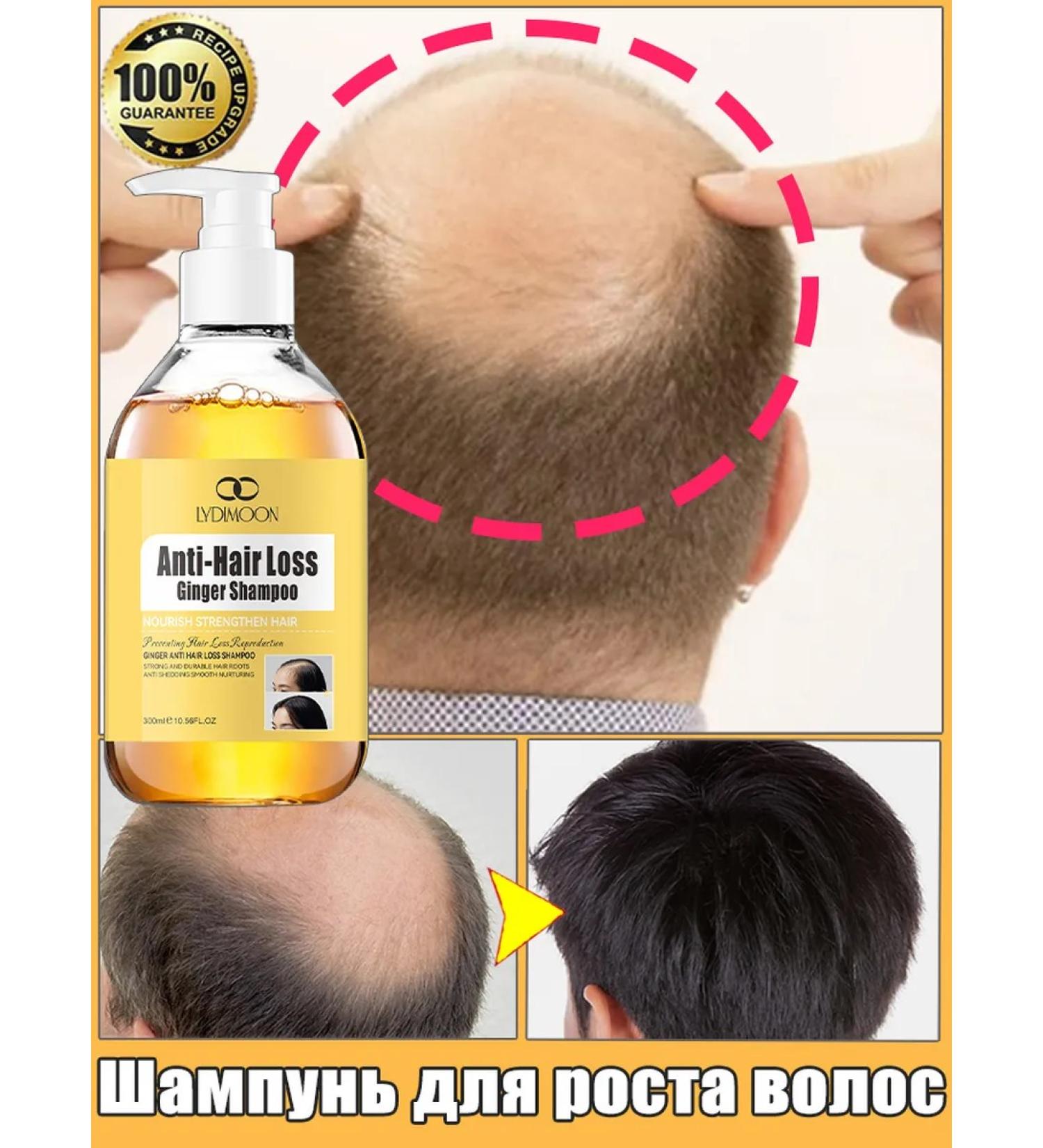 LYDIMOON Shampoo for hair growth and against falling out strengthens - Buy Online on GoSupps.com