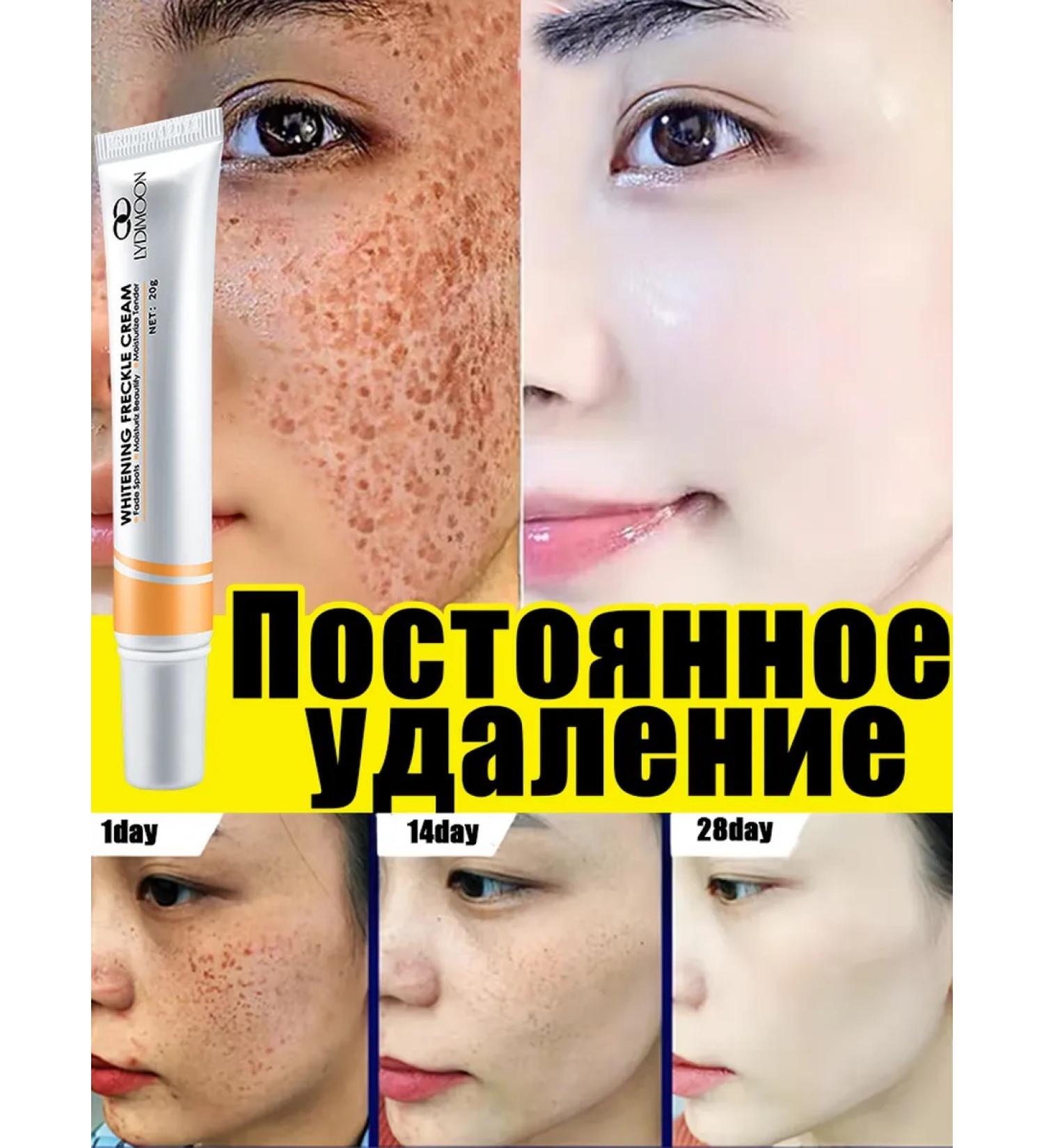 Cream against age spots and freckles to combat them - Buy Online on GoSupps.com