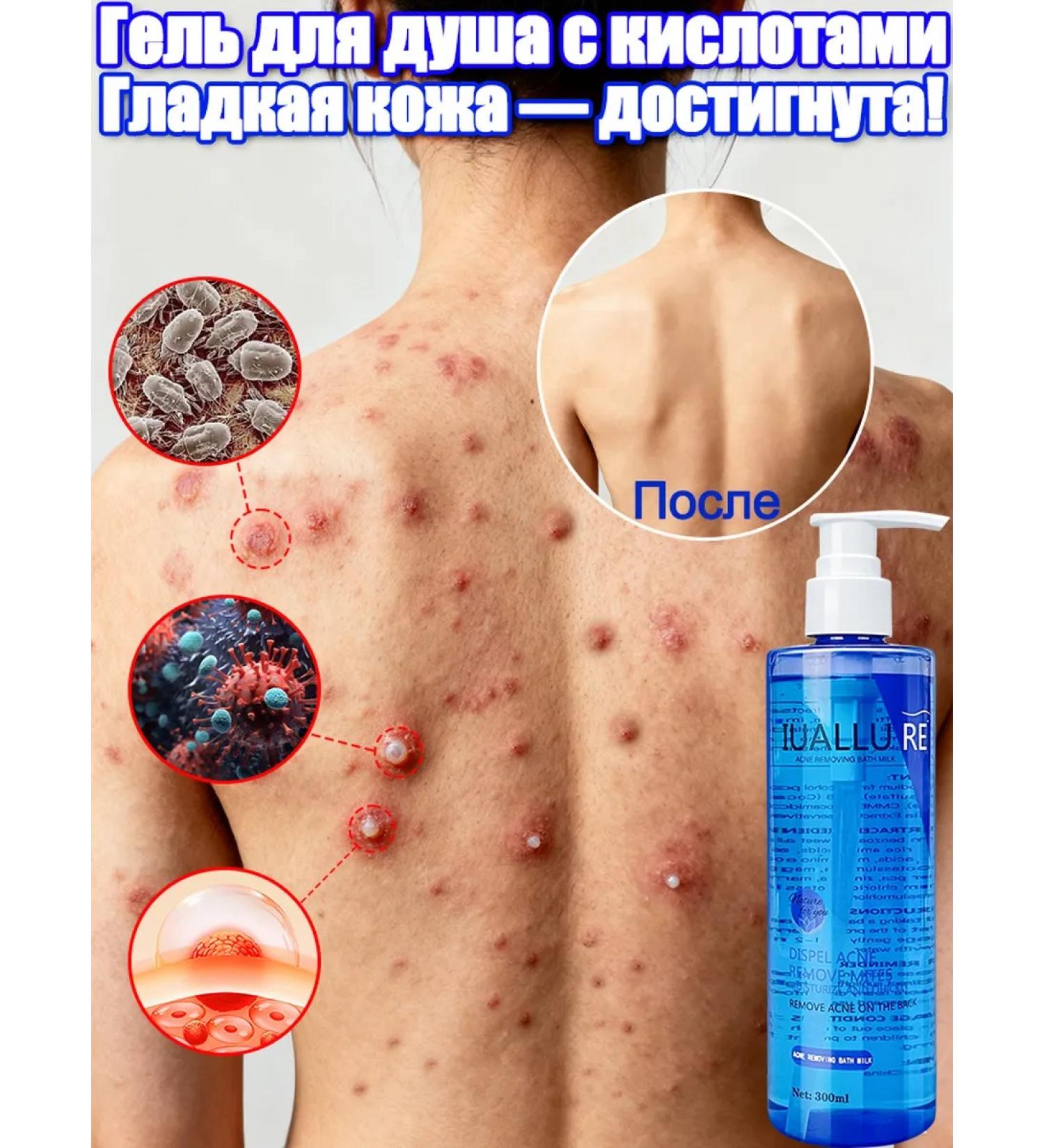 IUALLURE Shower gel with acids acne for all skin types 300 ml - Buy Online on GoSupps.com