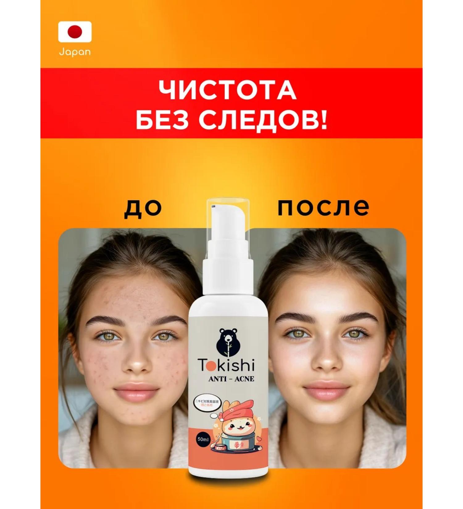 TOKISHI SB Acne cream serum - Buy Online on GoSupps.com