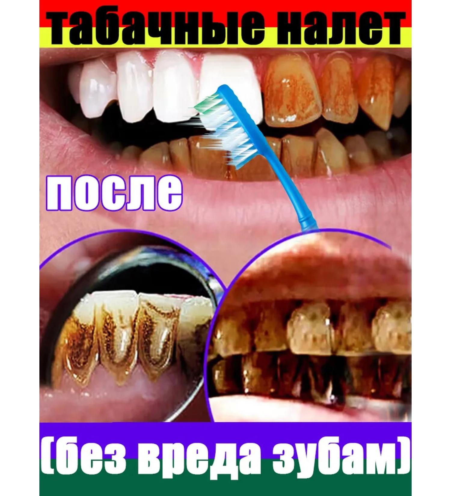 Toothpaste Filler with probiotics-giving raids - Buy Online on GoSupps.com