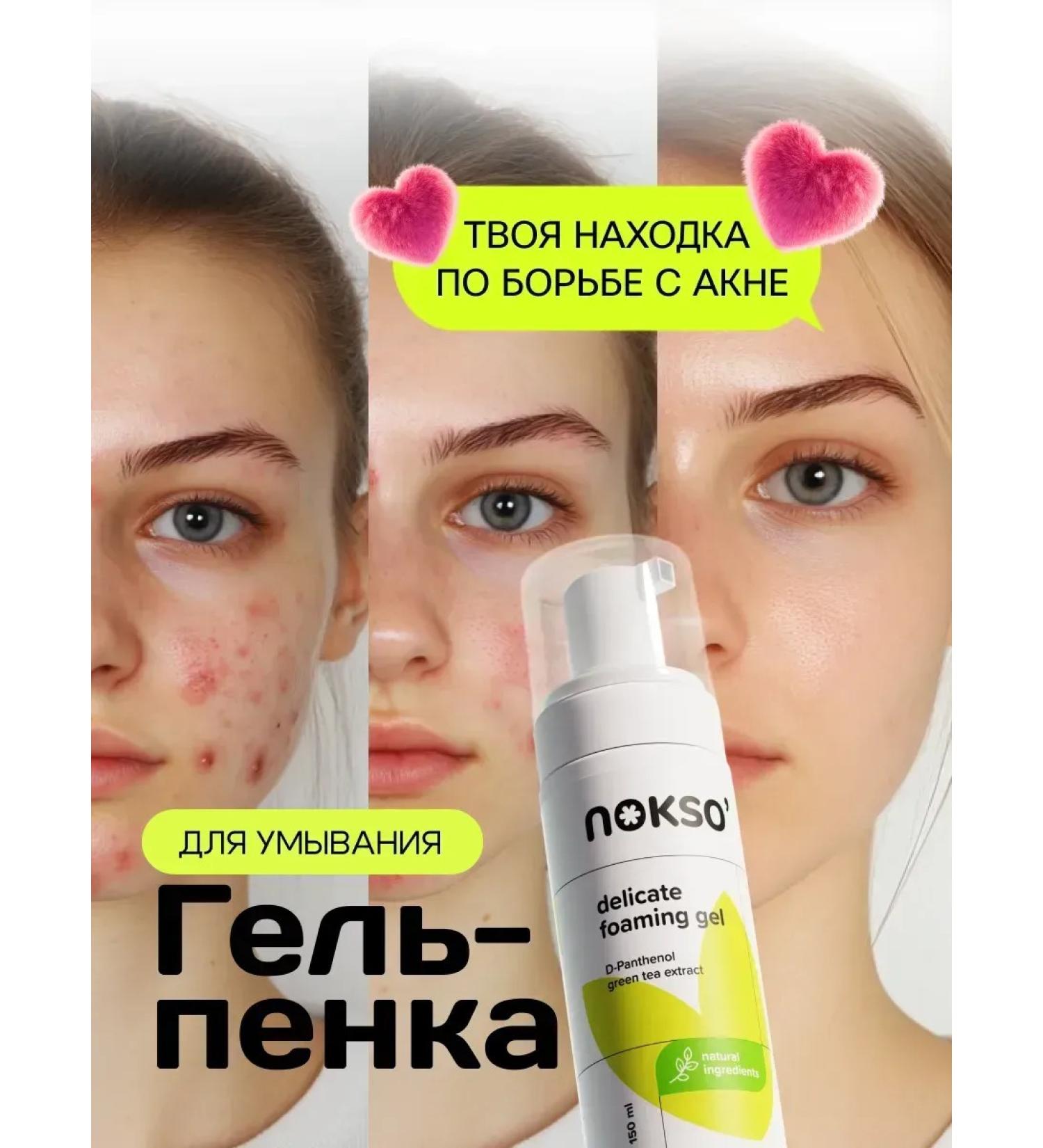Noxo Moisturizing foam for washing the face from acne - Buy Online on GoSupps.com