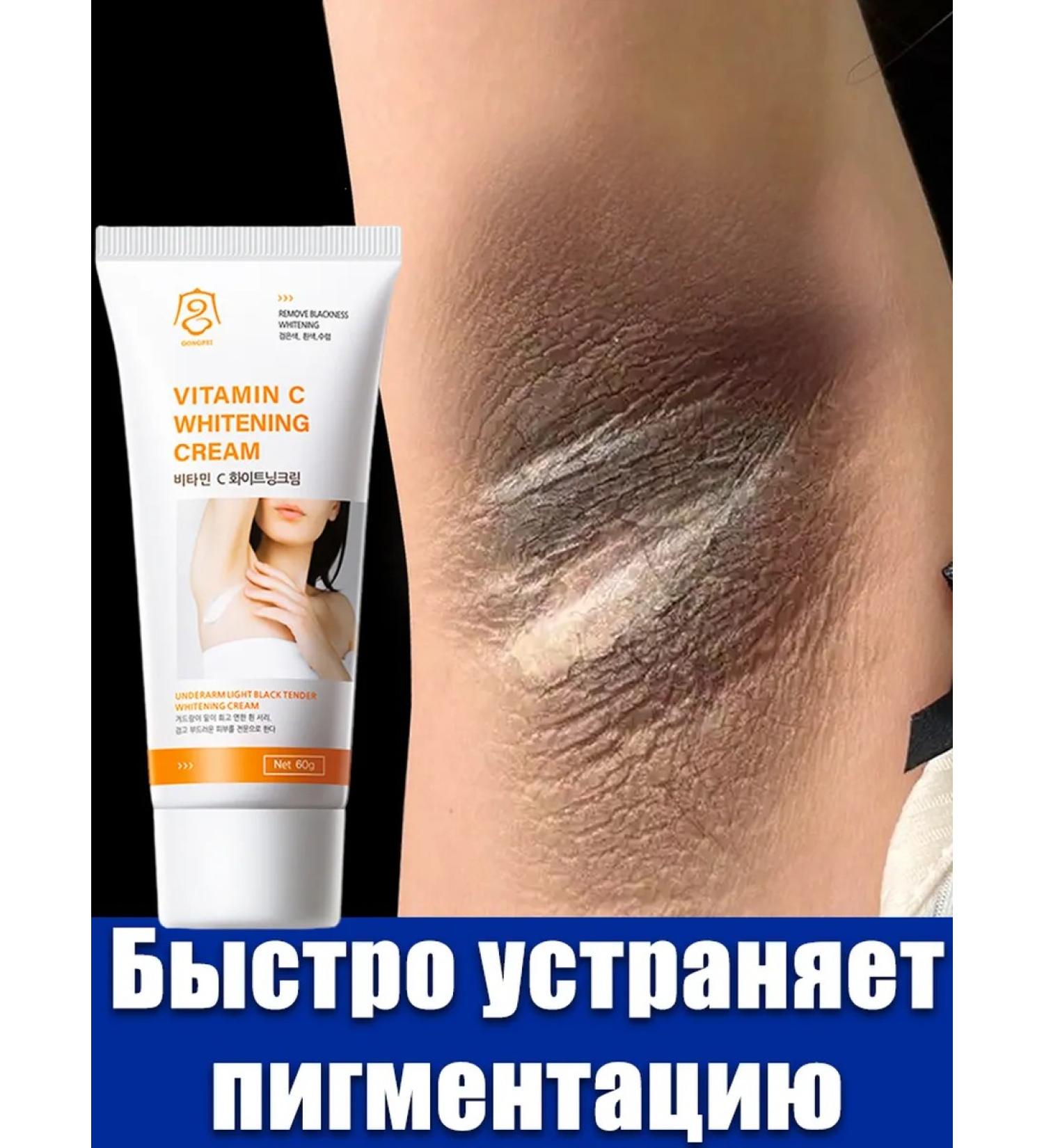 Whitening cream for intimate zones and body body. - Buy Online on GoSupps.com