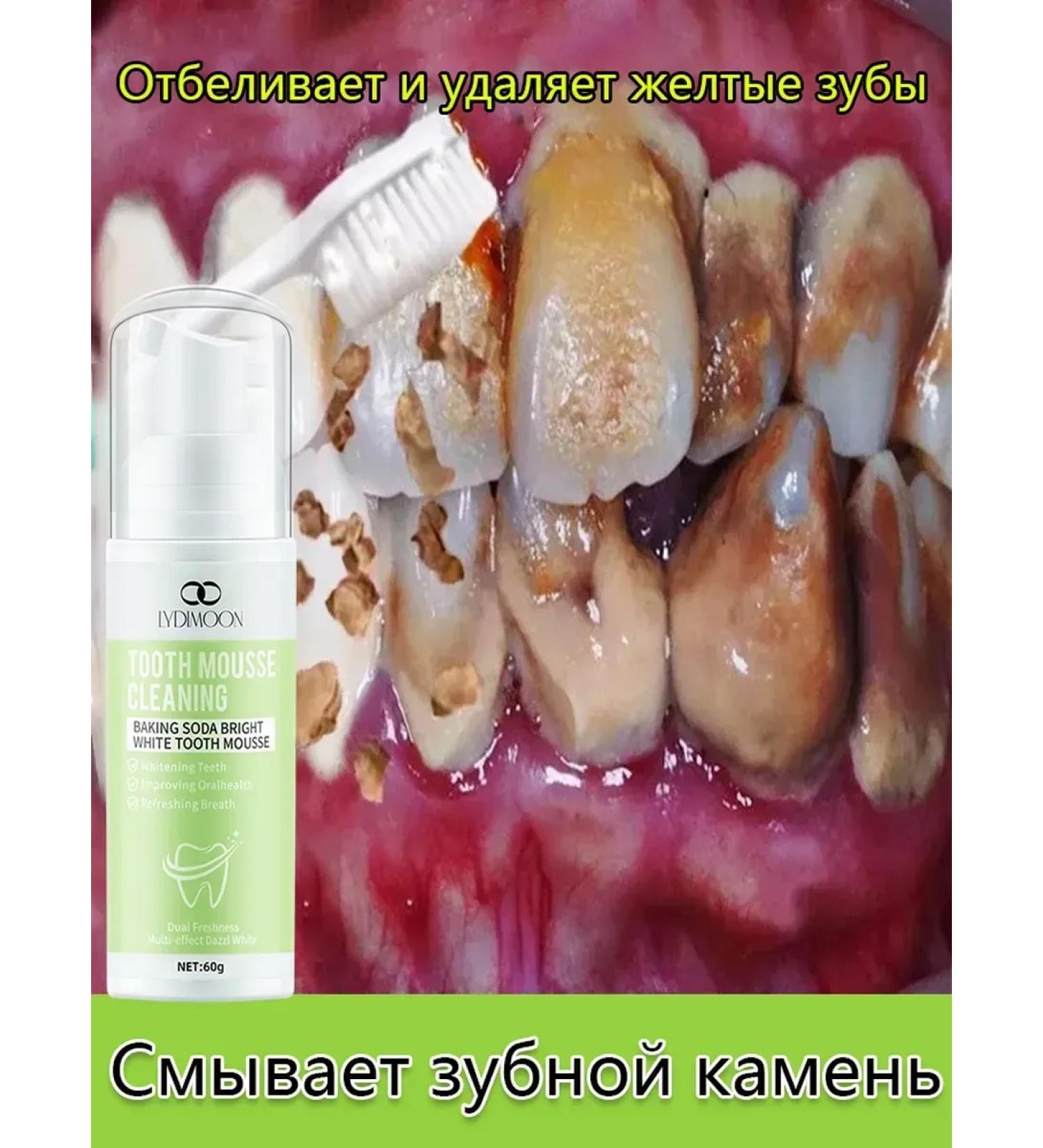 LYDIMOON Oral cleansing mousse - Buy Online on GoSupps.com