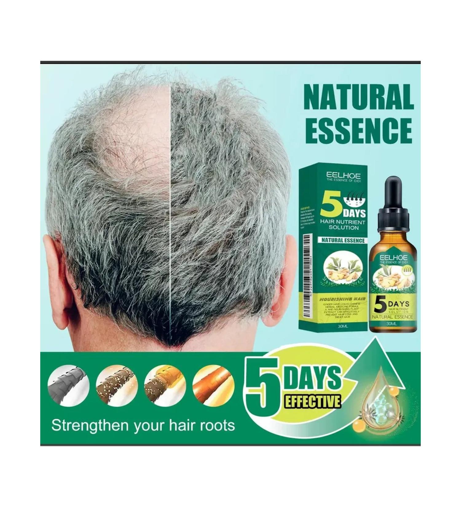 Klimenko Hair growth serum - Buy Online on GoSupps.com