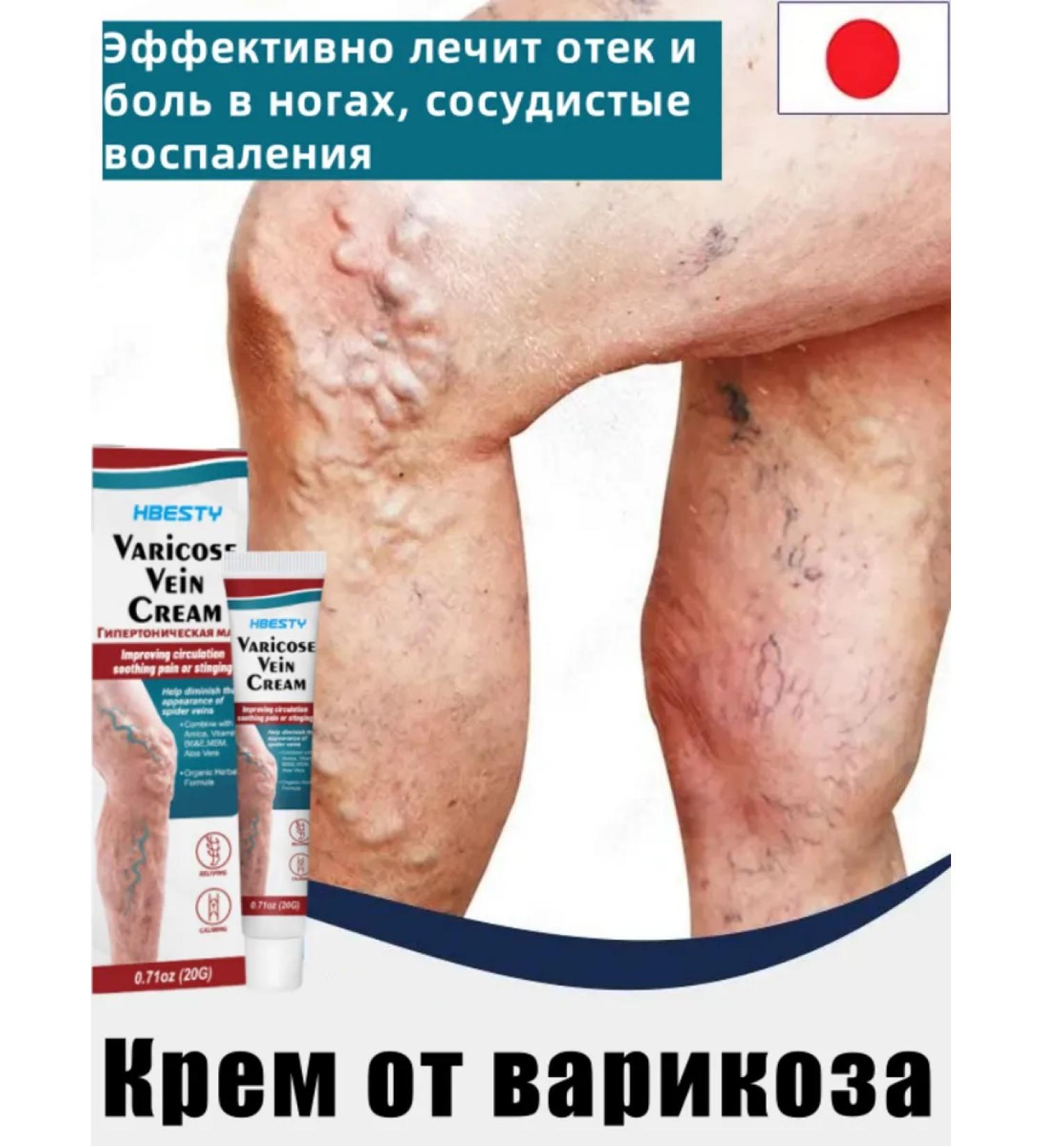 Cream from varicose veins 20g relieves pain and swelling - Buy Online on GoSupps.com
