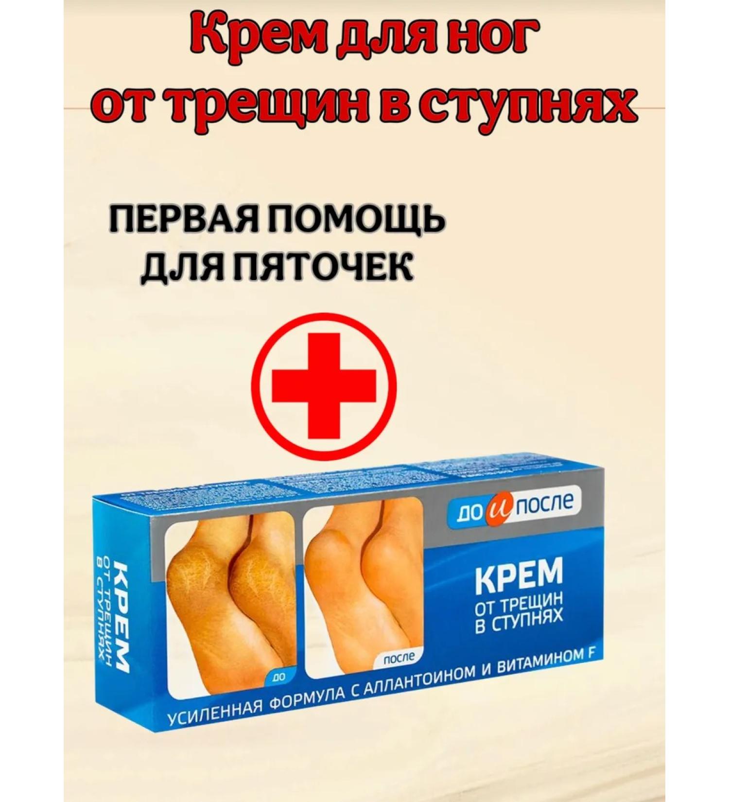 Feet cream from cracks on the feet and heels