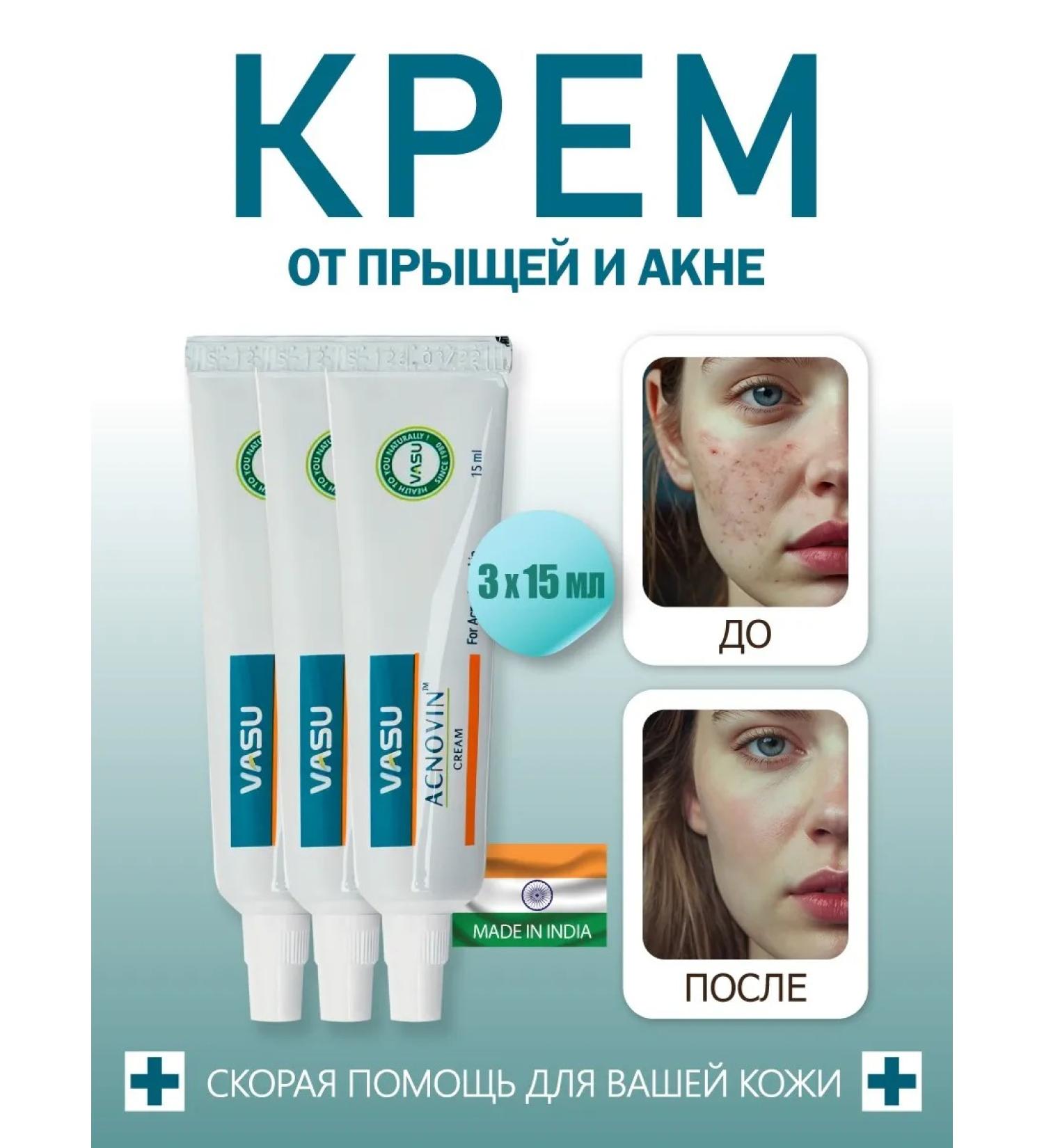 VASU Facial cream from acne 3 pcs - Buy Online on GoSupps.com