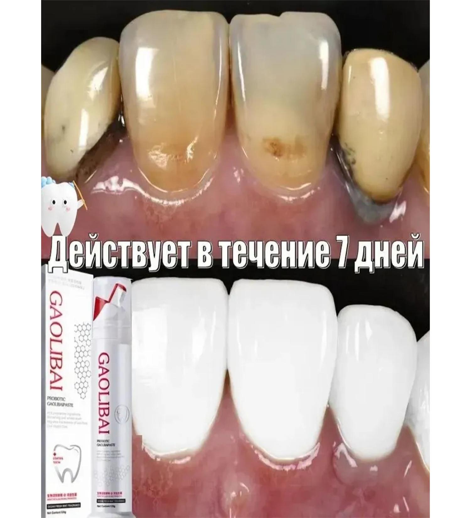 Toothpaste whitening without fluorine - Buy Online on GoSupps.com