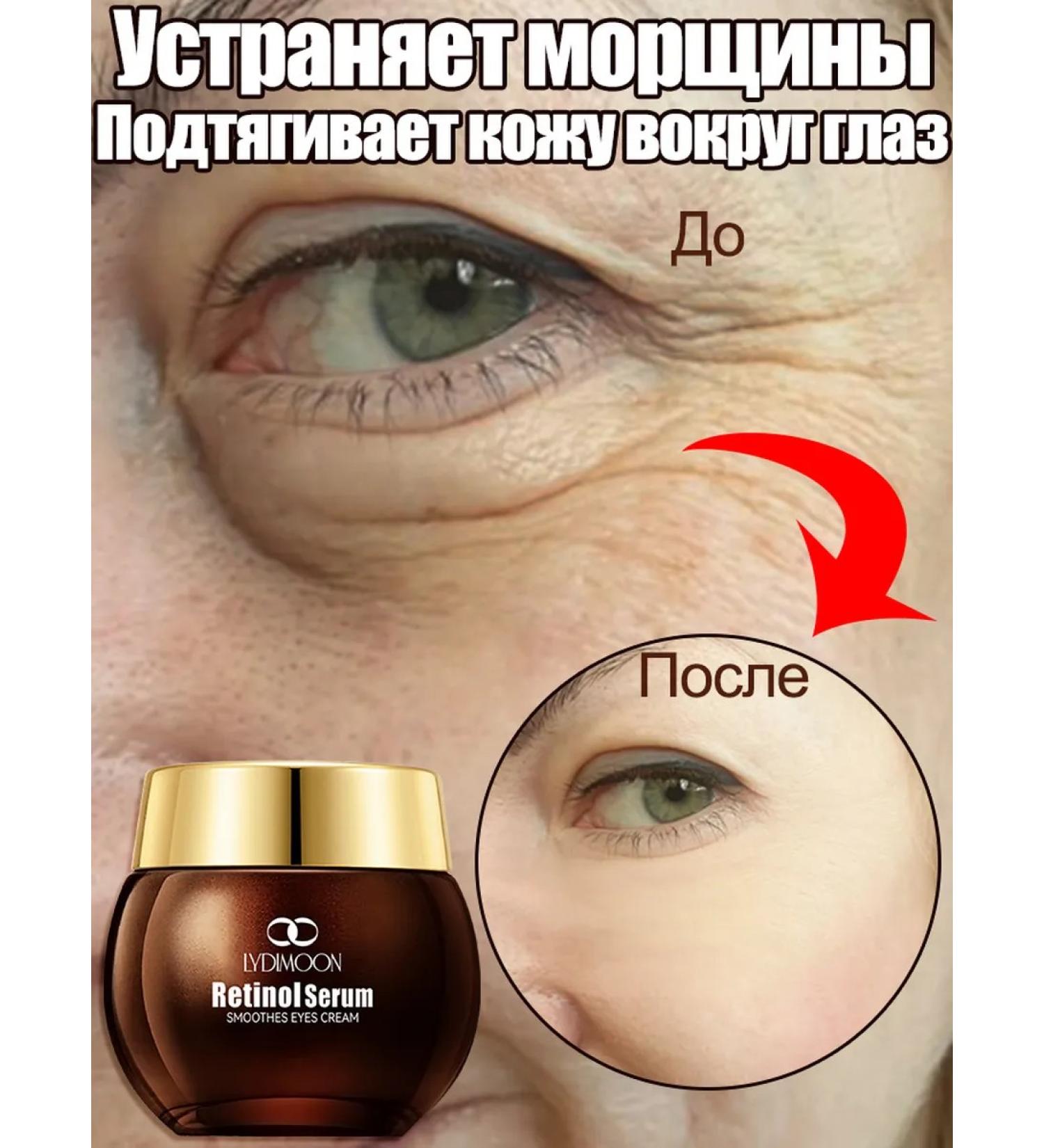 LYDIMOON Skin cream around the eyes anti -aging from wrinkles 35g - Buy Online on GoSupps.com