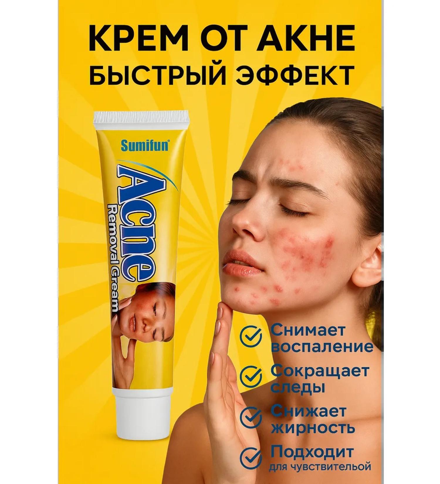 TIA Acne ointment and acne - Buy Online on GoSupps.com