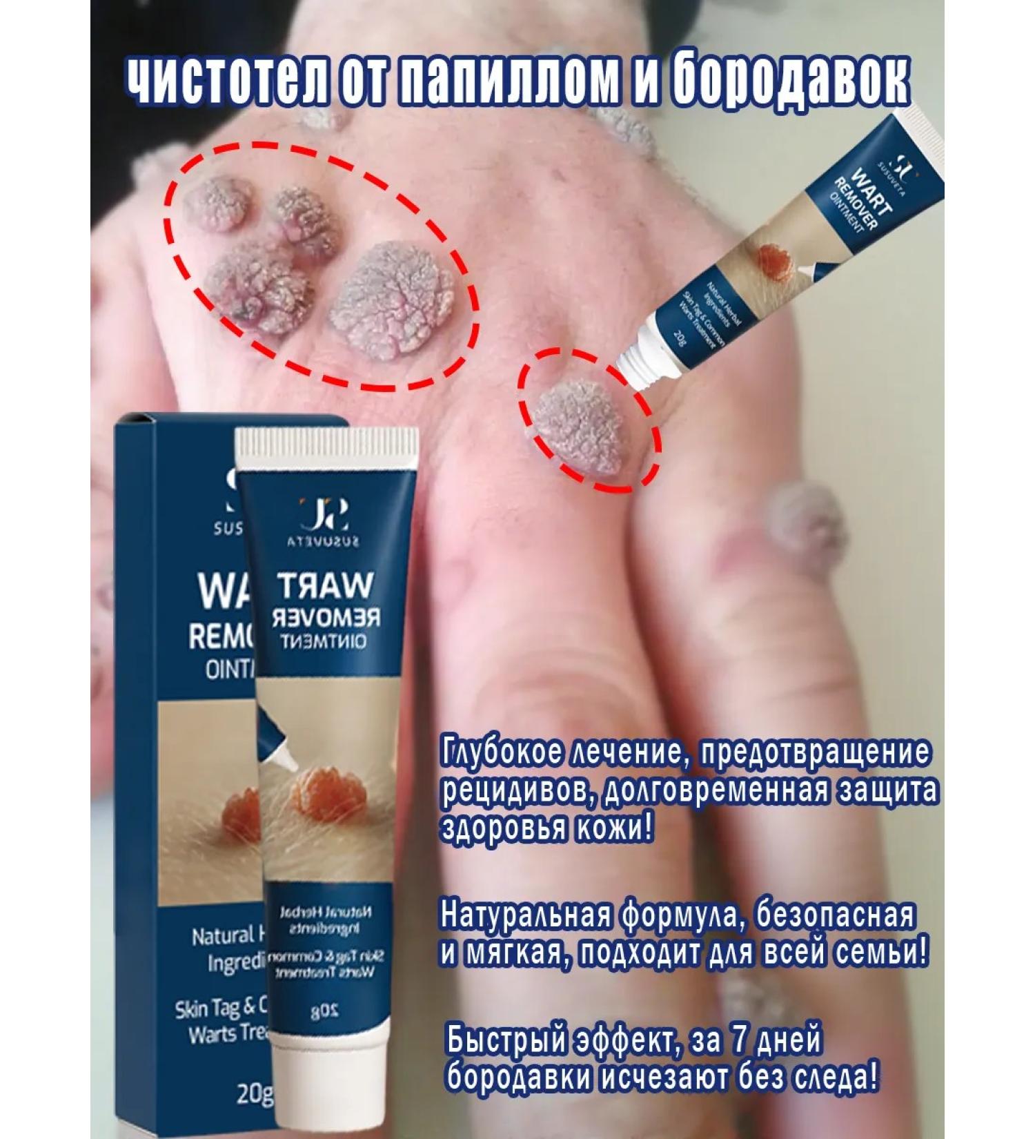 Ointment from warts papillomas and corns - Buy Online on GoSupps.com