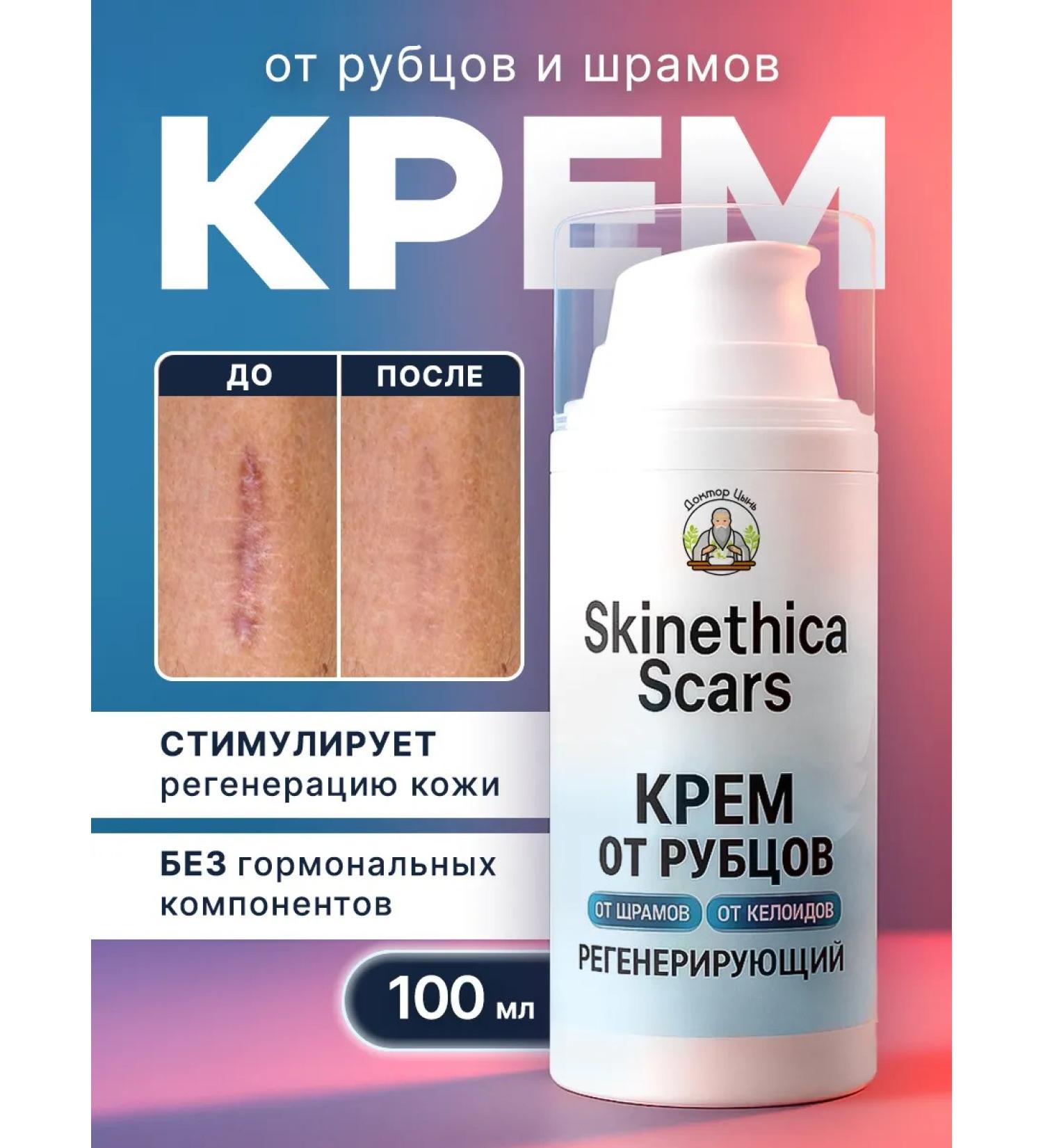 Cream from scars and scars - Buy Online on GoSupps.com