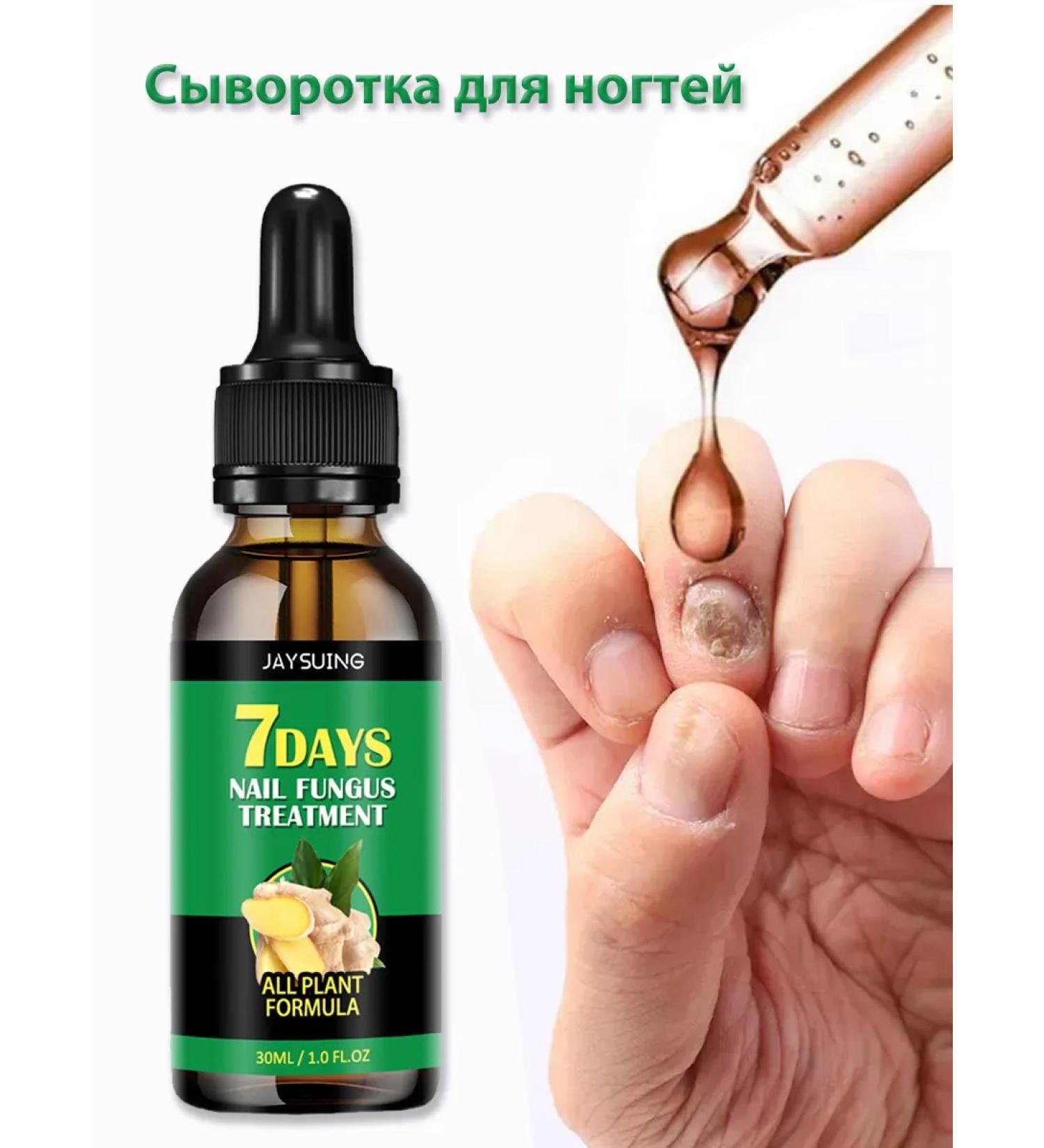 JaySuing nails with nails ginger solution suppress the growth of fungi 30 ml - Buy Online on GoSupps.com