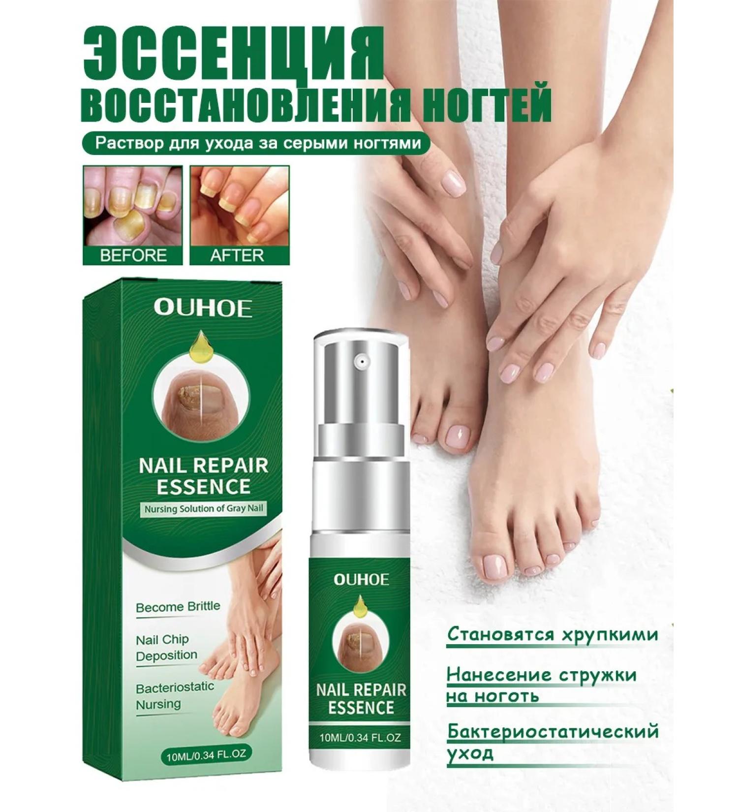 Ouhoe Treatment of nail fungus Essence to improve the yellow spot - Buy Online on GoSupps.com