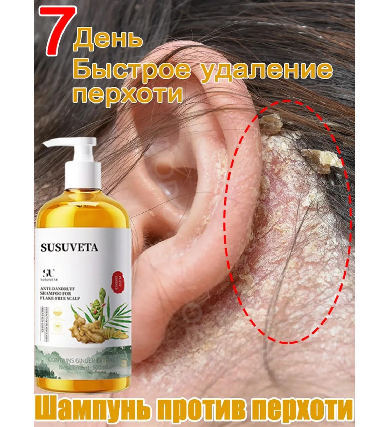 Hair growth shampoo with ginger 500 ml - Buy Online on GoSupps.com