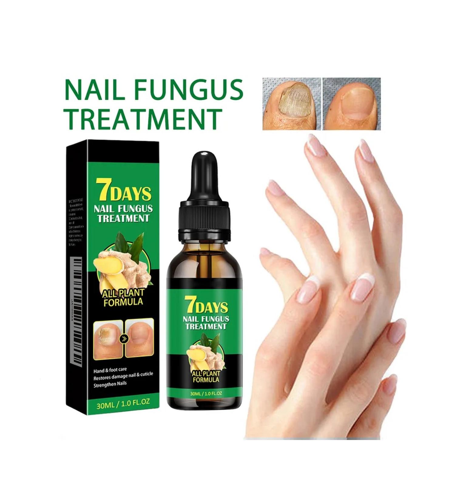 30ml ginger sulfur for nails against the fungus moisturizing - Buy Online on GoSupps.com