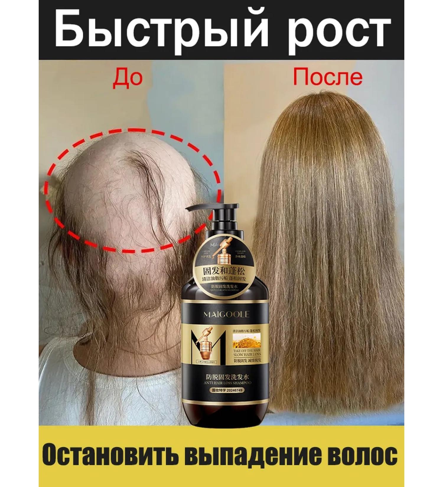 LYDIMOON Hair growth shampoo and 200ml loss - Buy Online on GoSupps.com