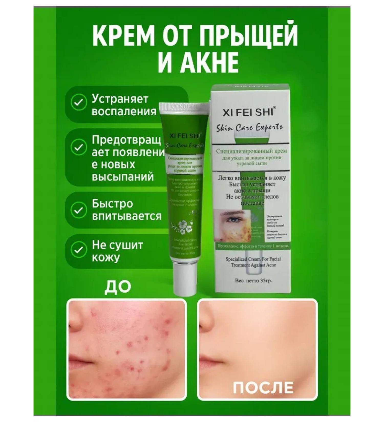 Everbloom Acne cream on the face of the shoulders from acne comedones - Buy Online on GoSupps.com