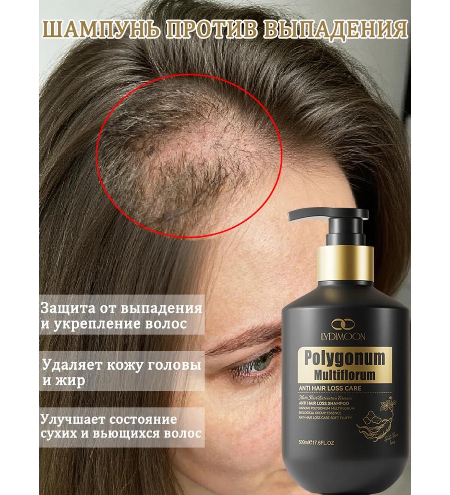 LYDIMOON 3 bottles of shampoo against hair loss - Buy Online on GoSupps.com